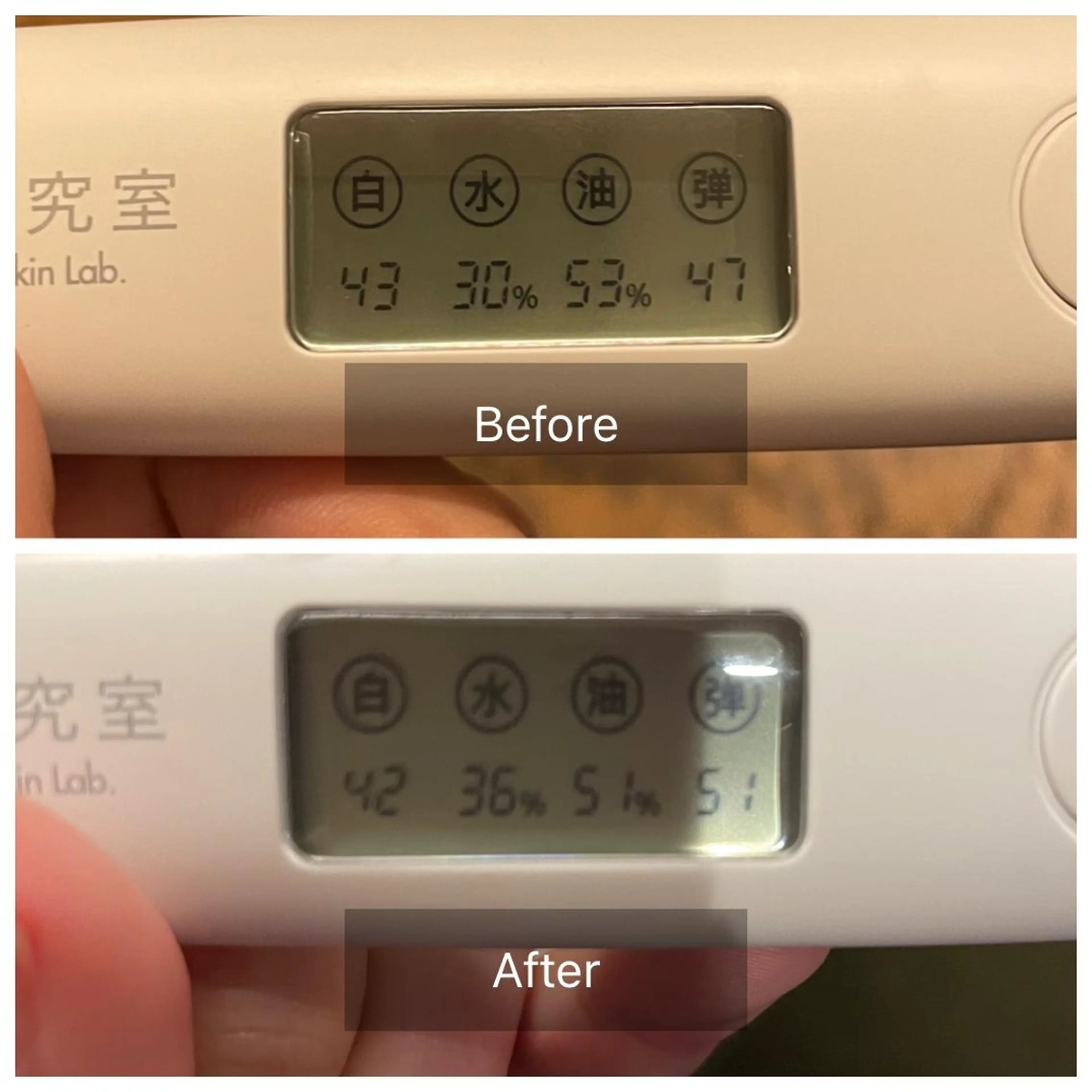 美容鍼　蒼月-aotsuki-所属・美容鍼「蒼月」 -アオツキ-のエステ・リラクイメージ