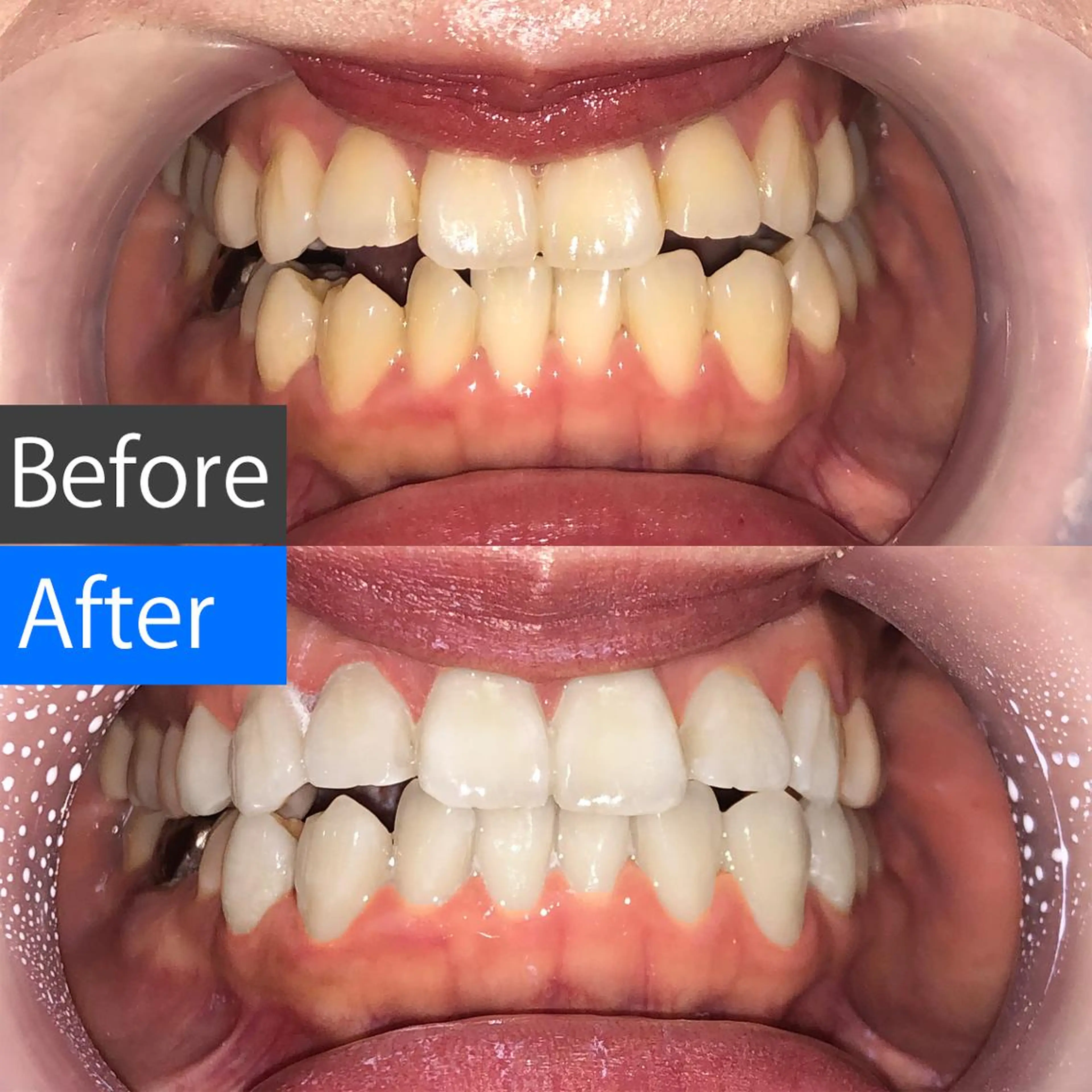 ネイル アイブロウ マツエク・マツパ ショート パーマ メンズ キッズ カラー メンズ就活ヘア オフィスネイル ホワイト その他 中目黒 ホワイトニングサロンのその他イメージ