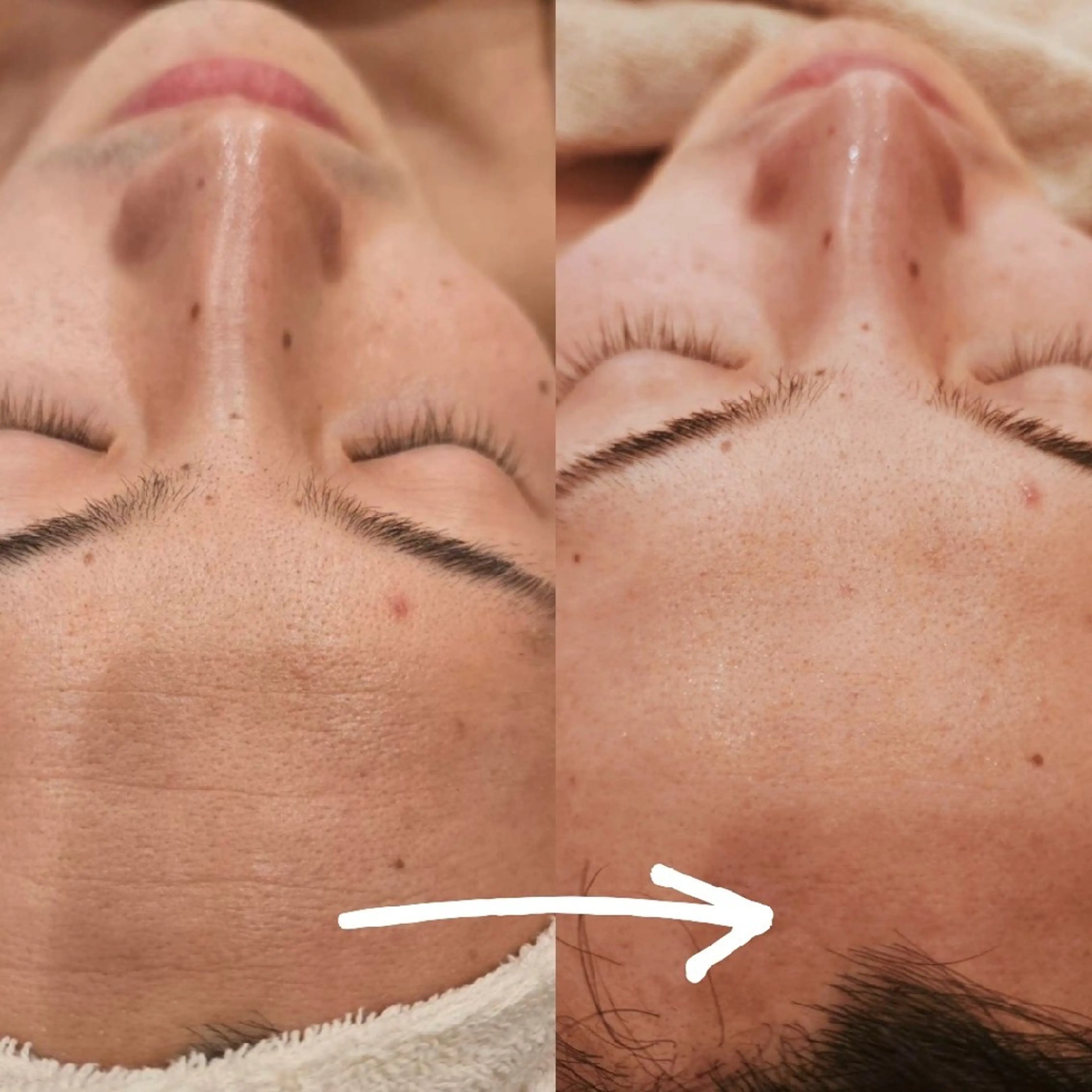 エステ ベル チェリカ 三城のエステ・リラクイメージ