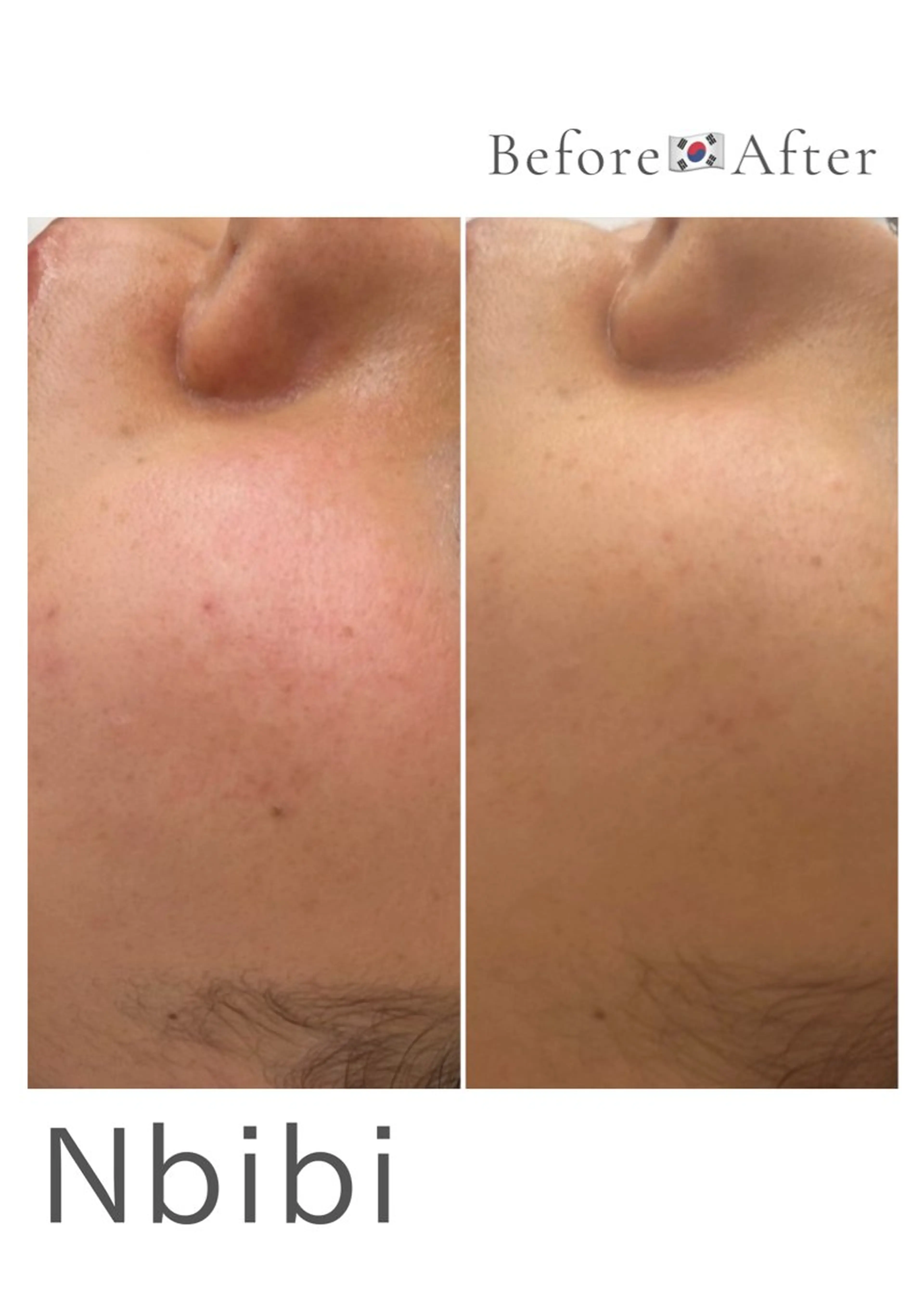 韓国🇰🇷価格 サロン_Nbibiのエステ・リラクイメージ