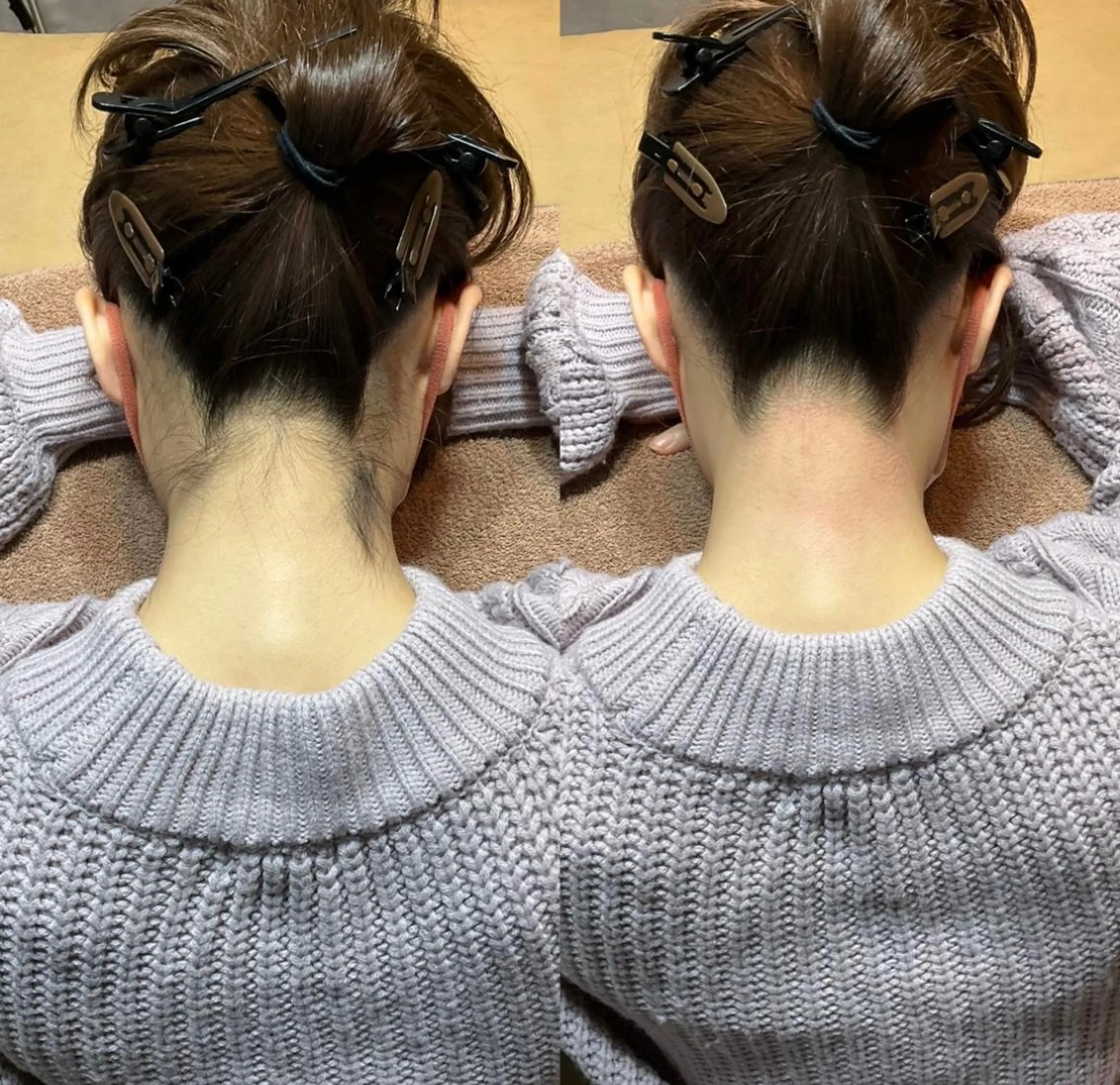 【🍋】うなじシュガーリングの写真