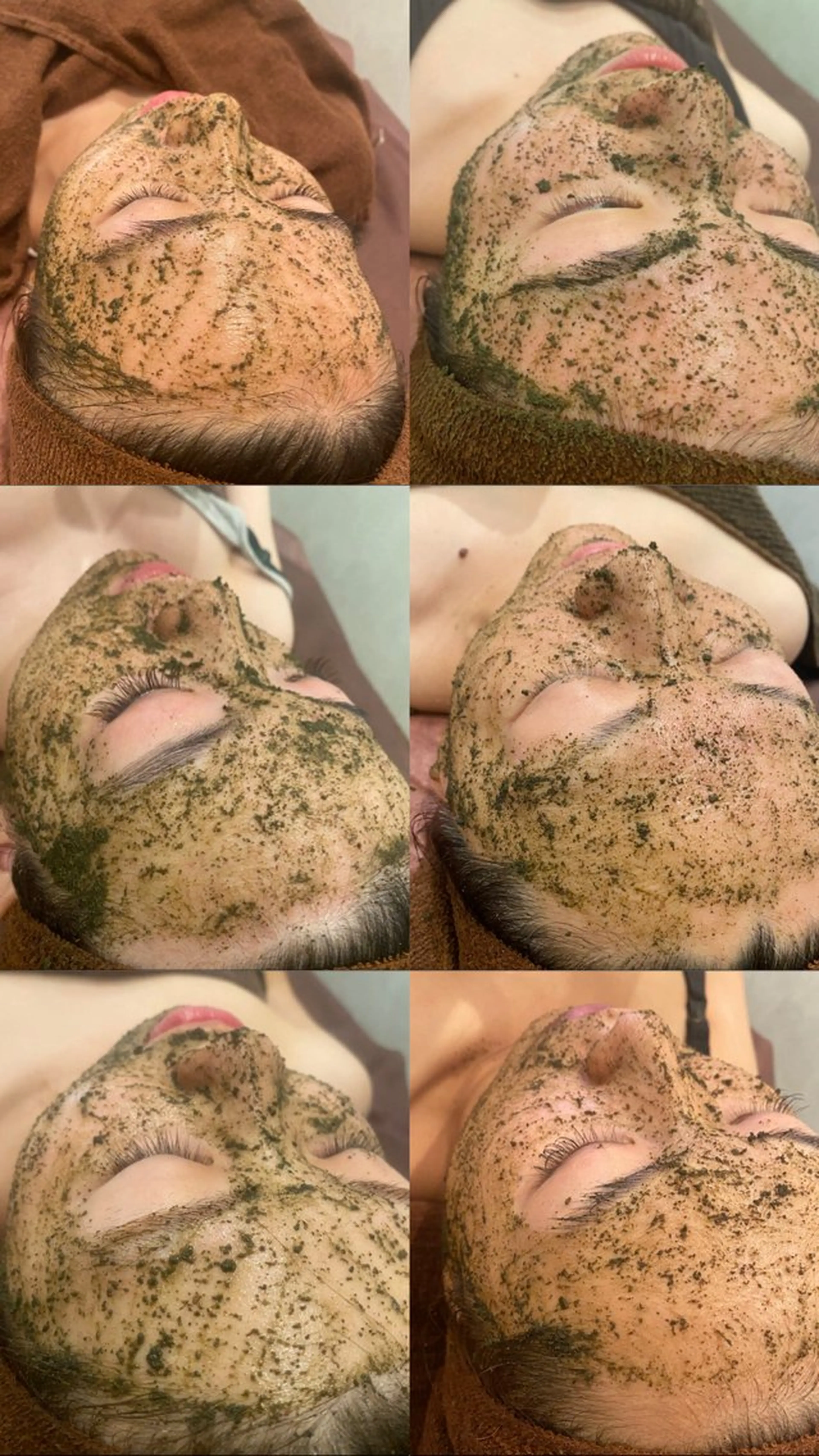 revi剥離なし陶器トリートメント❤️ハーブピーリング 🌿ミニモ限定価格🌹の写真