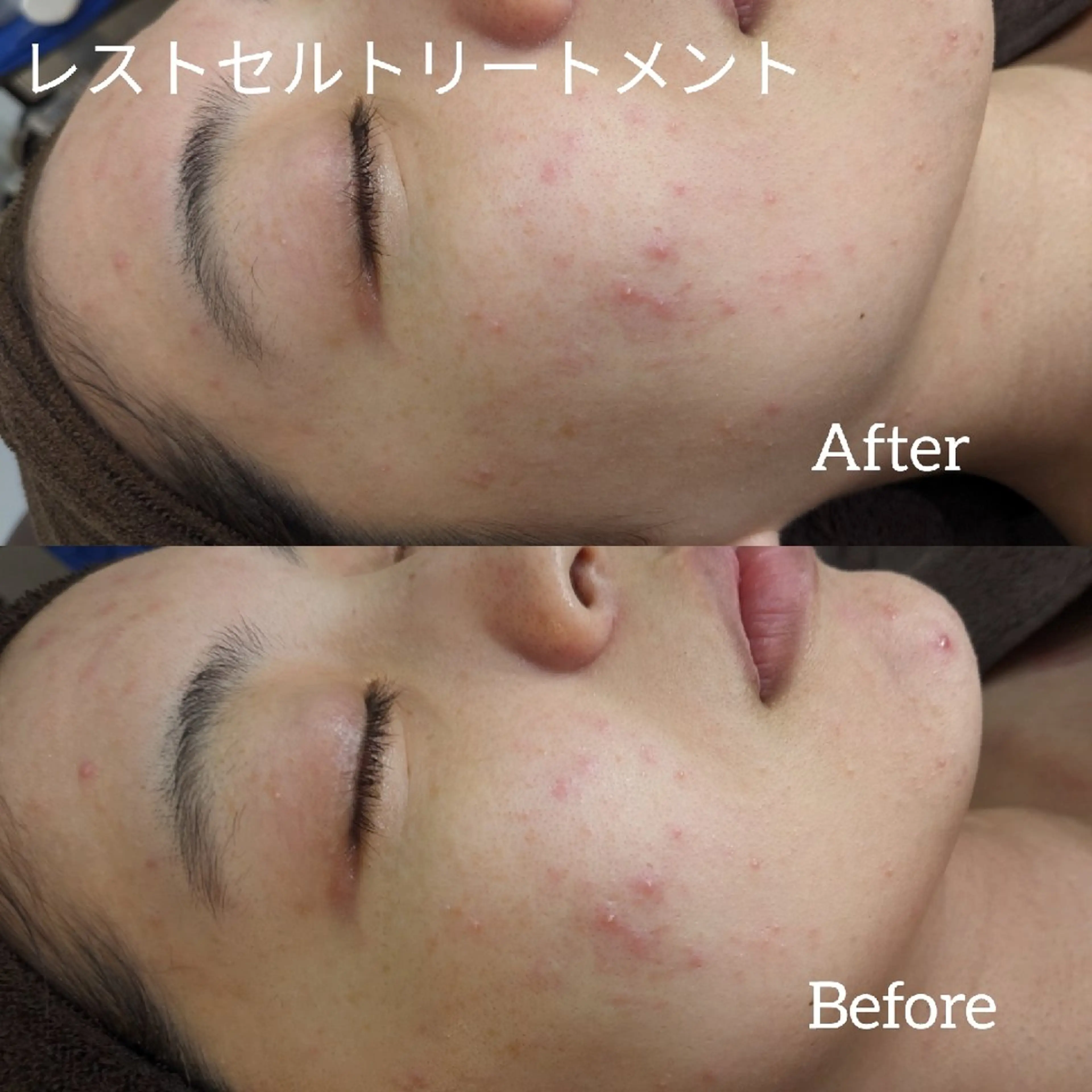 エステ ﾌｪｲｼｬﾙｴｽﾃ ﾗﾄｩｰﾙ伊深のエステ・リラクイメージ