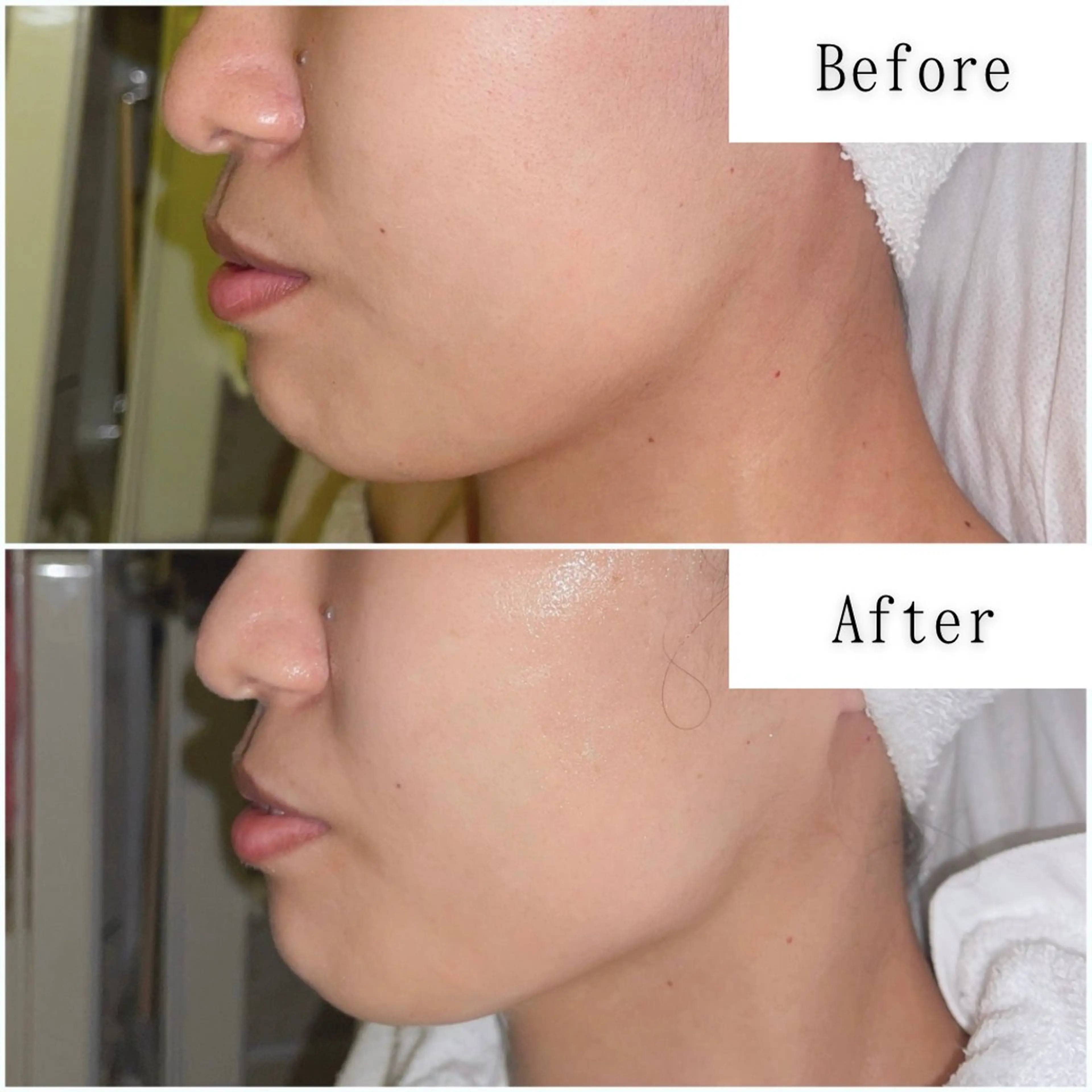 エステ SELF  BEAUTY gracia浦添店所属・gracia 浦添店のその他イメージ