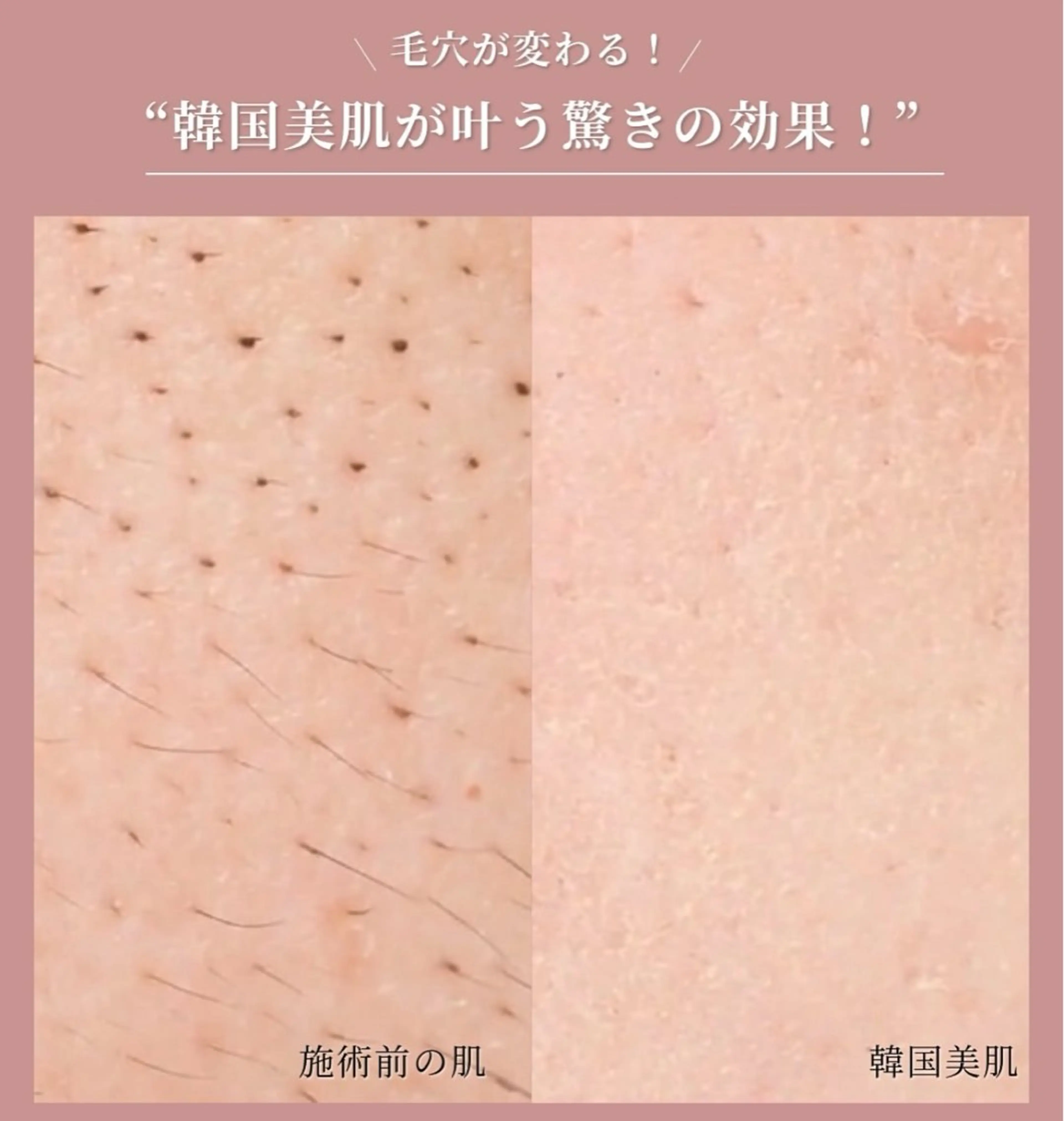 美肌育成専門サロンラクシュミー所属・毛穴肌管理サロン ラクシュミーのエステ・リラクイメージ