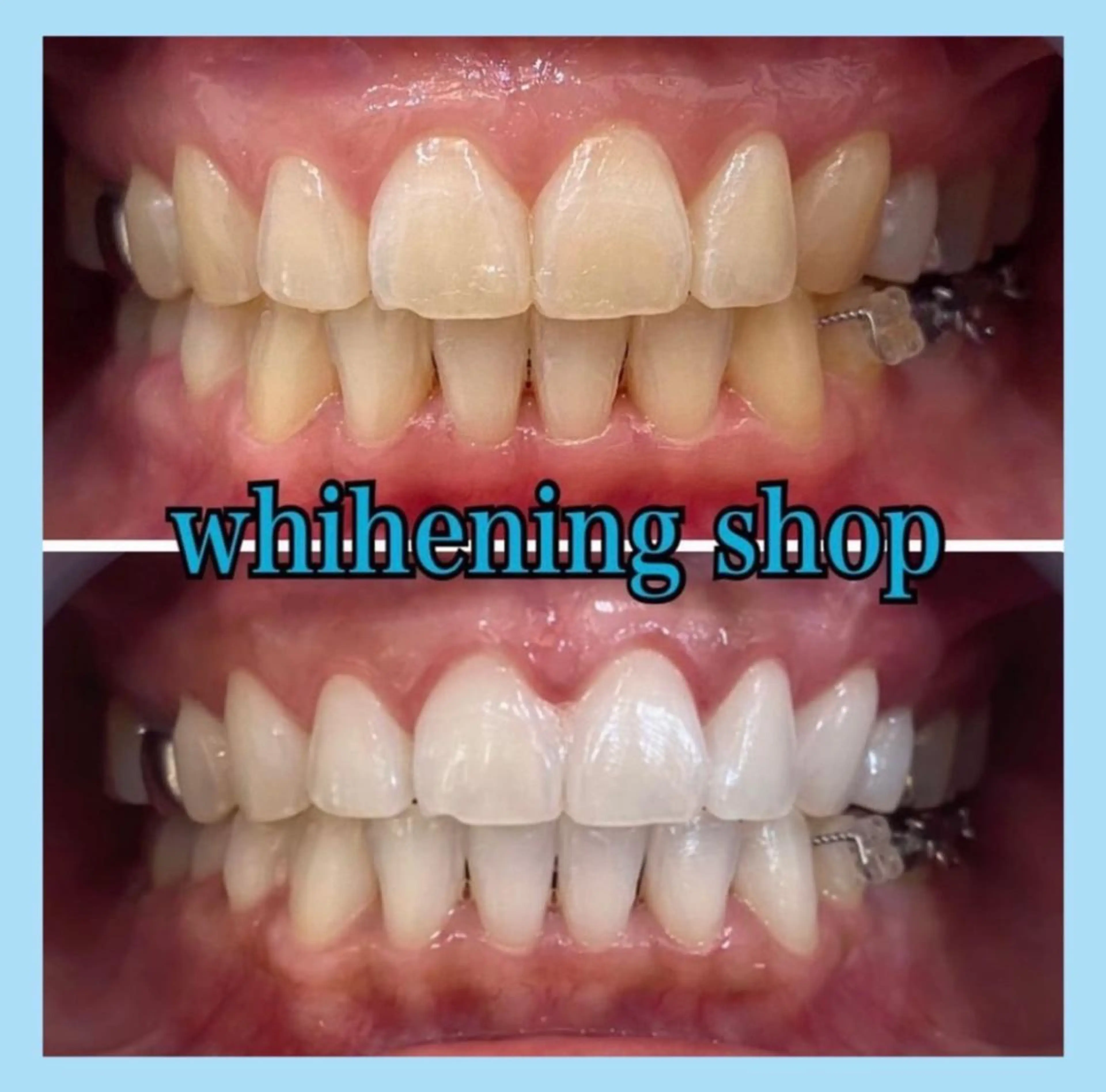 ホワイトニング ショップ千葉店のその他イメージ