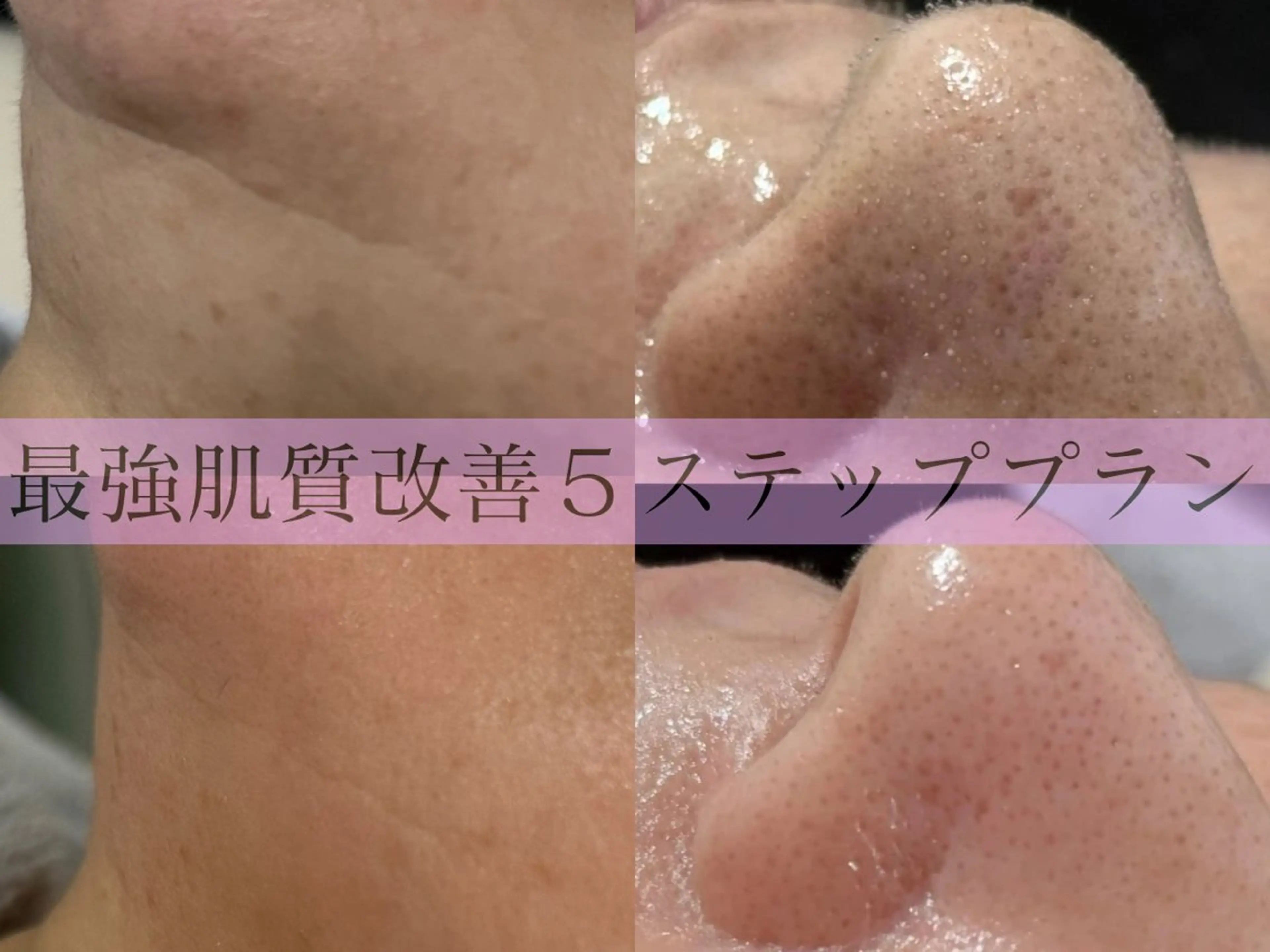 エステ Rairy所属・Rairy Salon富士見町のエステ・リラクイメージ