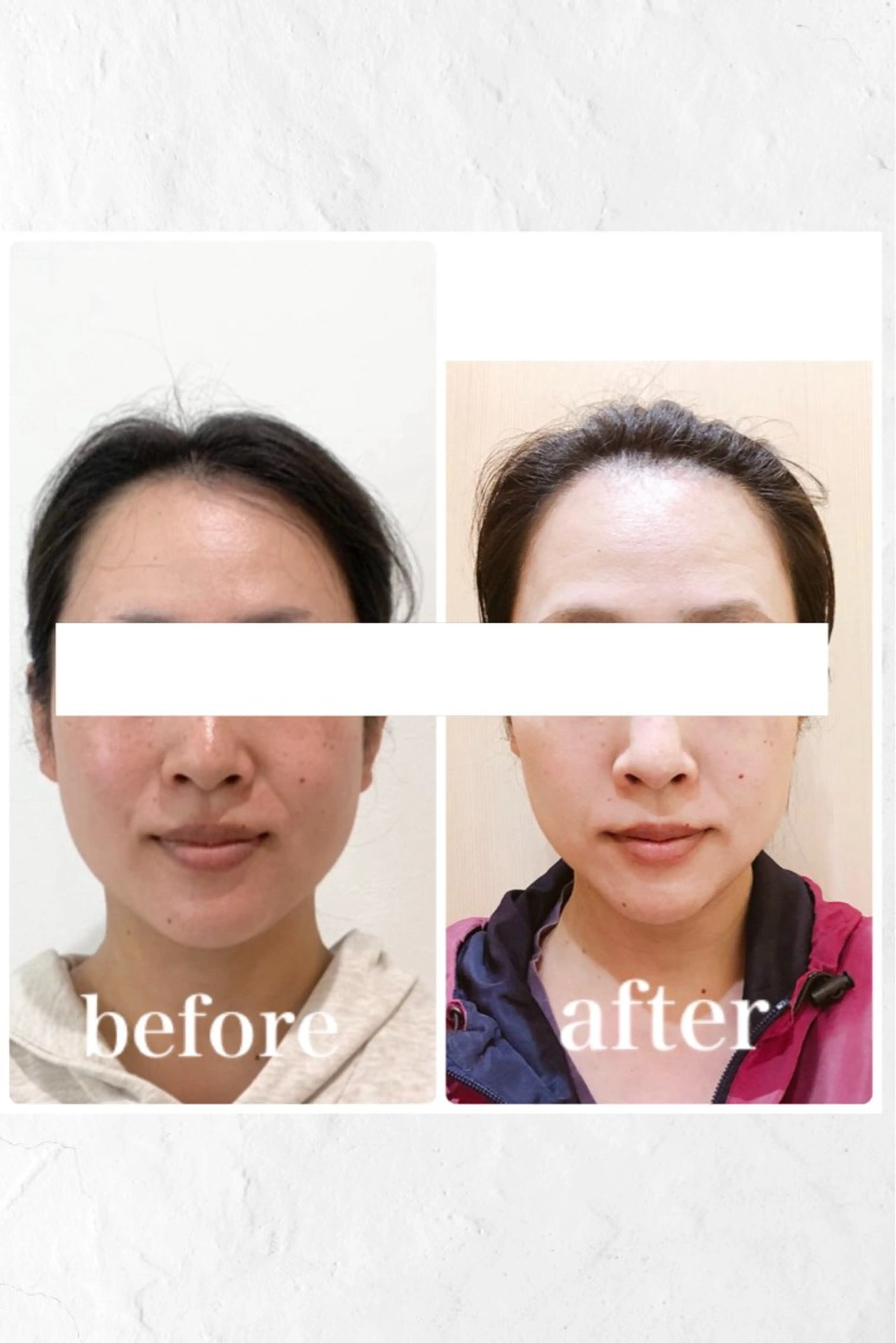 エステ リラク 小顔と ヘッドスパのお店のエステ・リラクイメージ