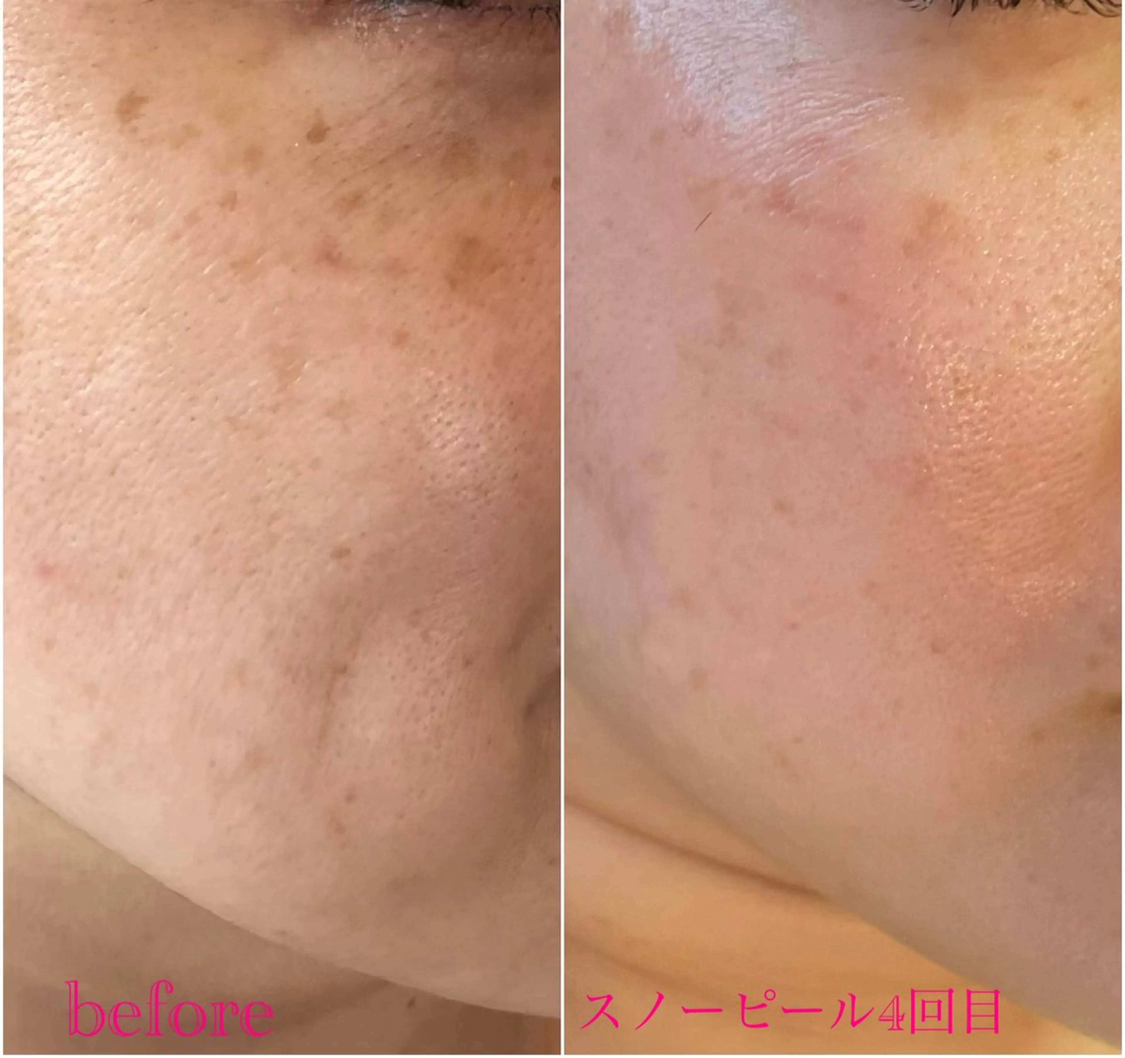 フィユ所属・〚博多〛フィユ 水江のマツエク・マツパデザイン