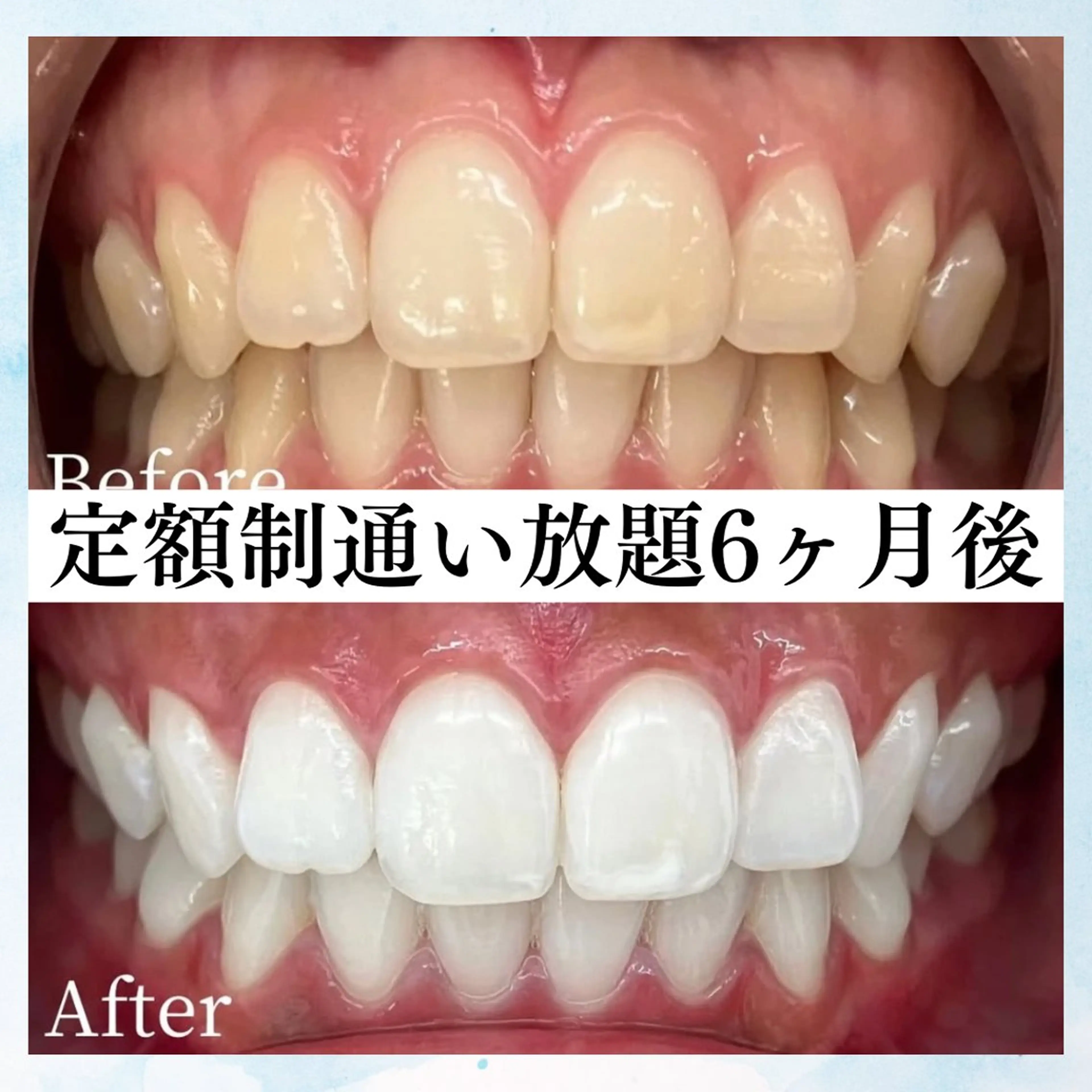 メンズ ホワイトニング専門店 WHITE天神店のエステ・リラクイメージ