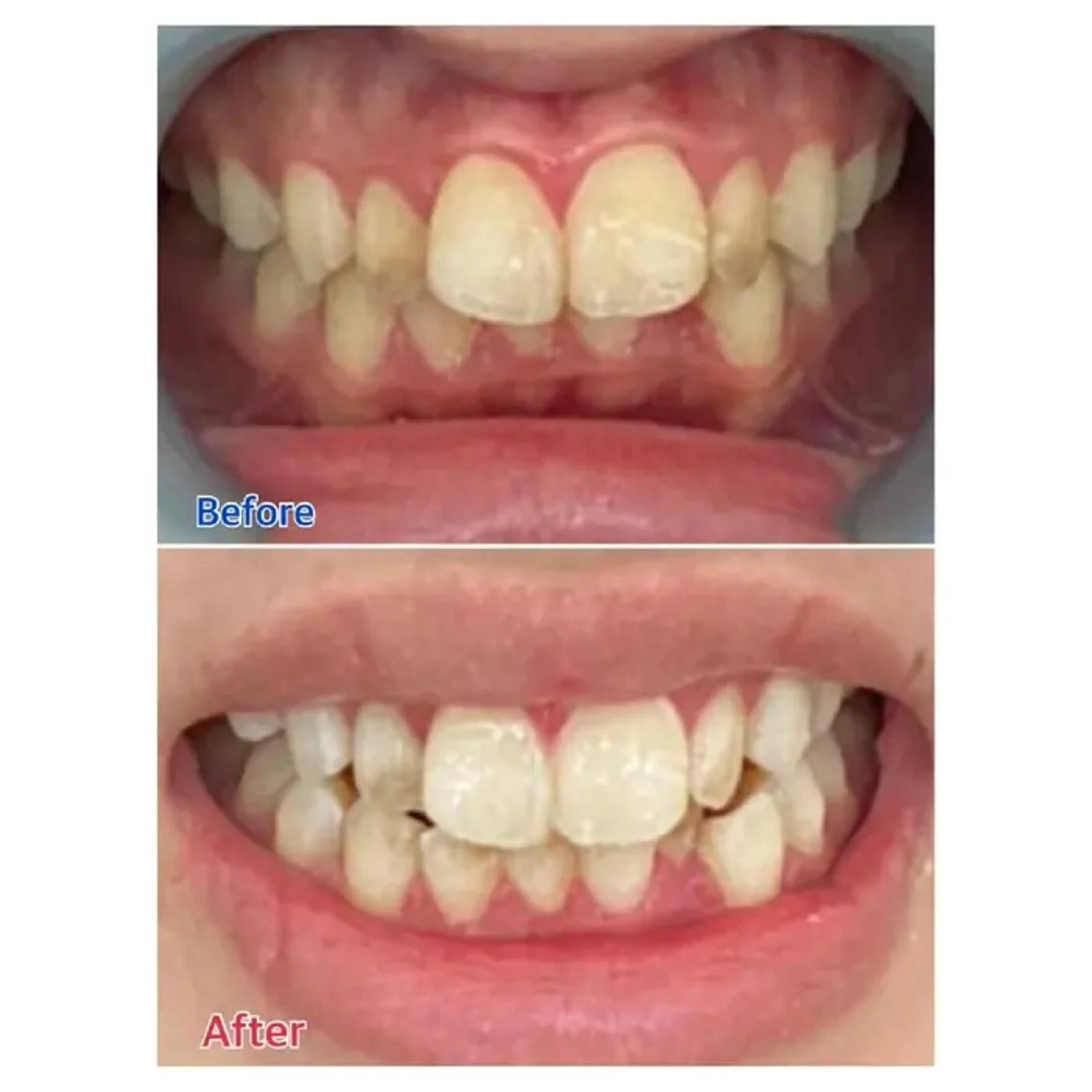 M渋谷店所属・Ｍ渋谷 ホワイトニングのその他イメージ