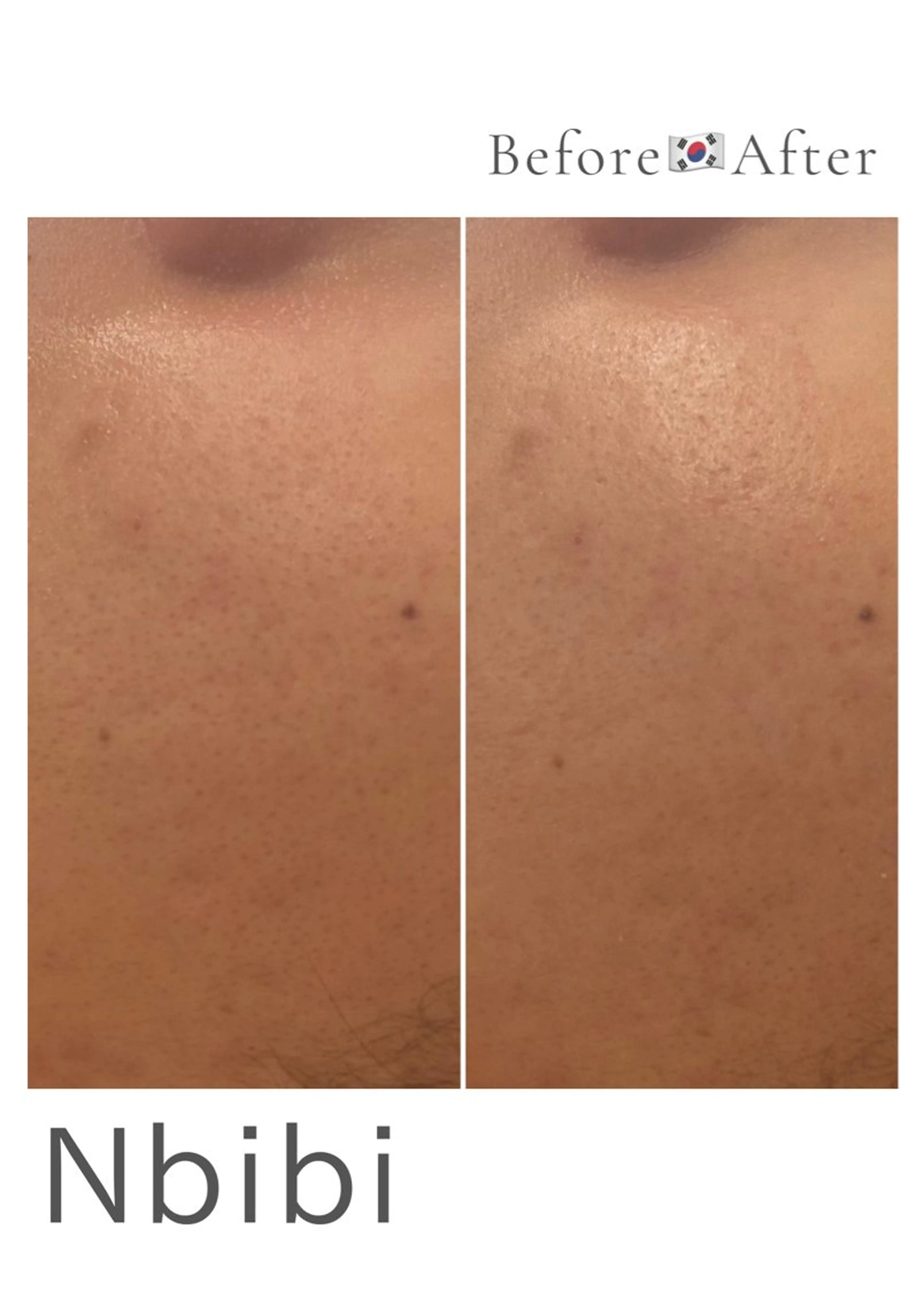 韓国🇰🇷価格 サロン_Nbibiのエステ・リラクイメージ