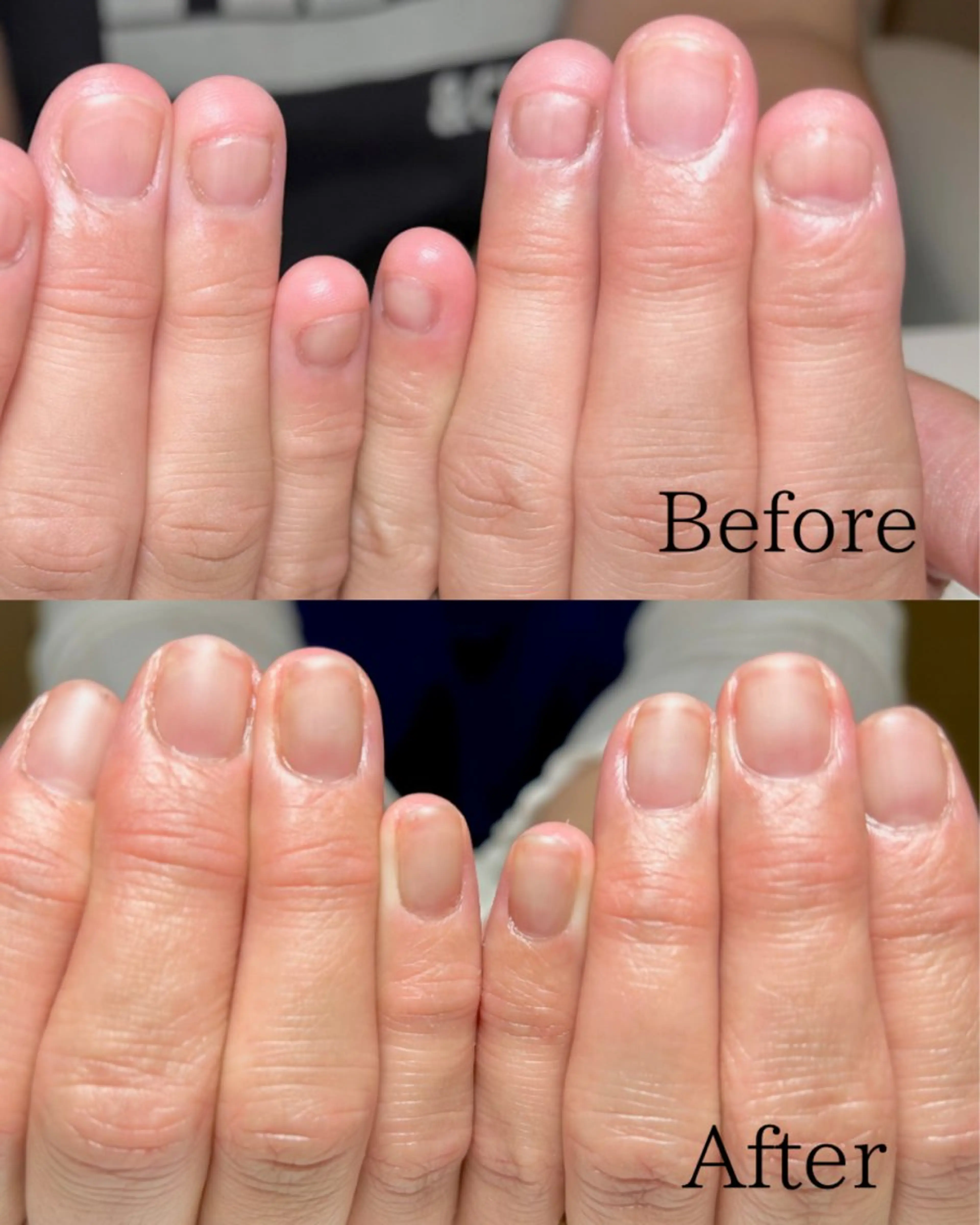 ネイル 深爪・自爪育成専門 MAHALOHIのネイルデザイン