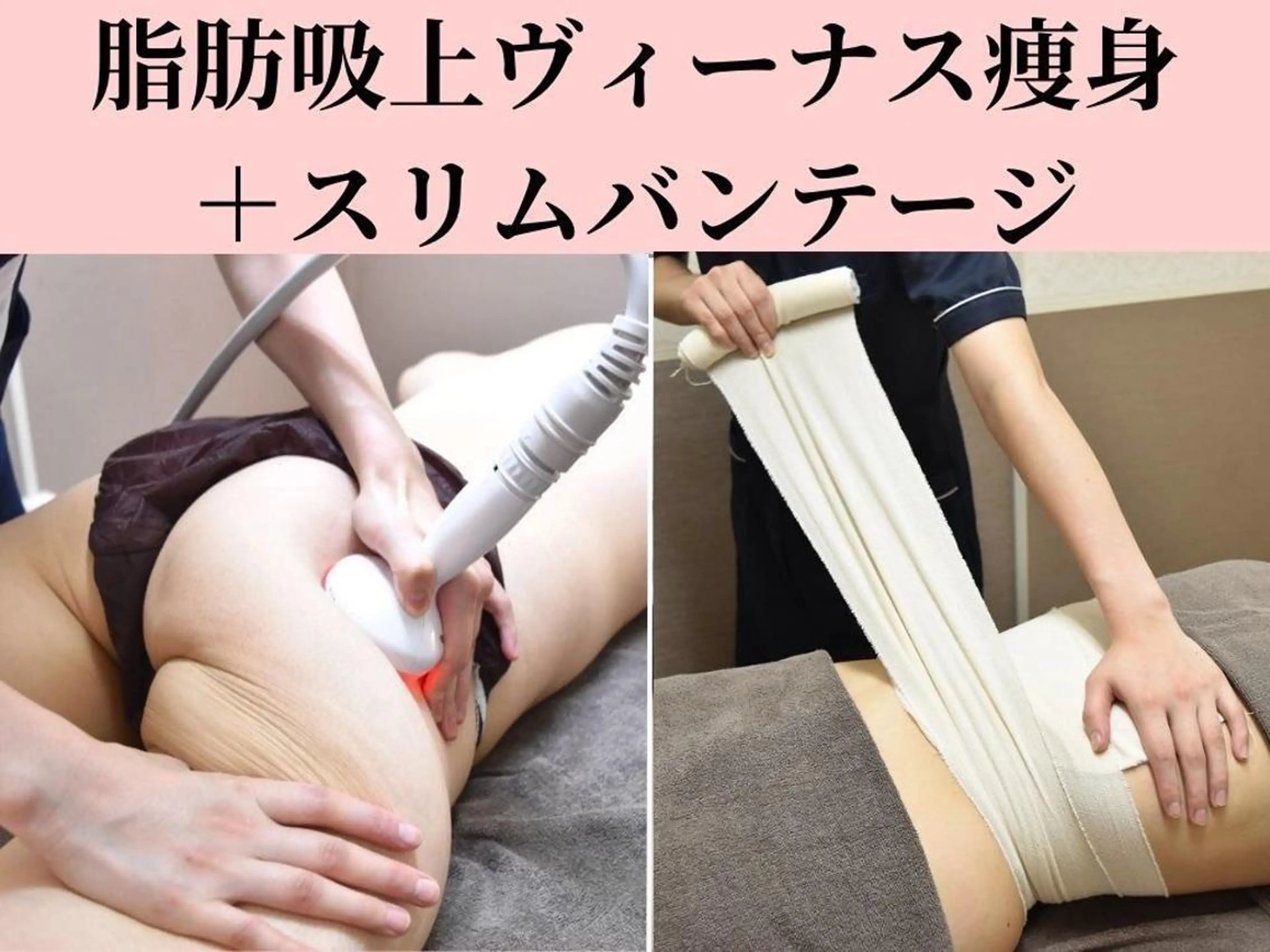 【定額痩身】筋膜造形!!万能特許取得マシン/ヴィーナス痩身＋SLIMバンテ50分の写真