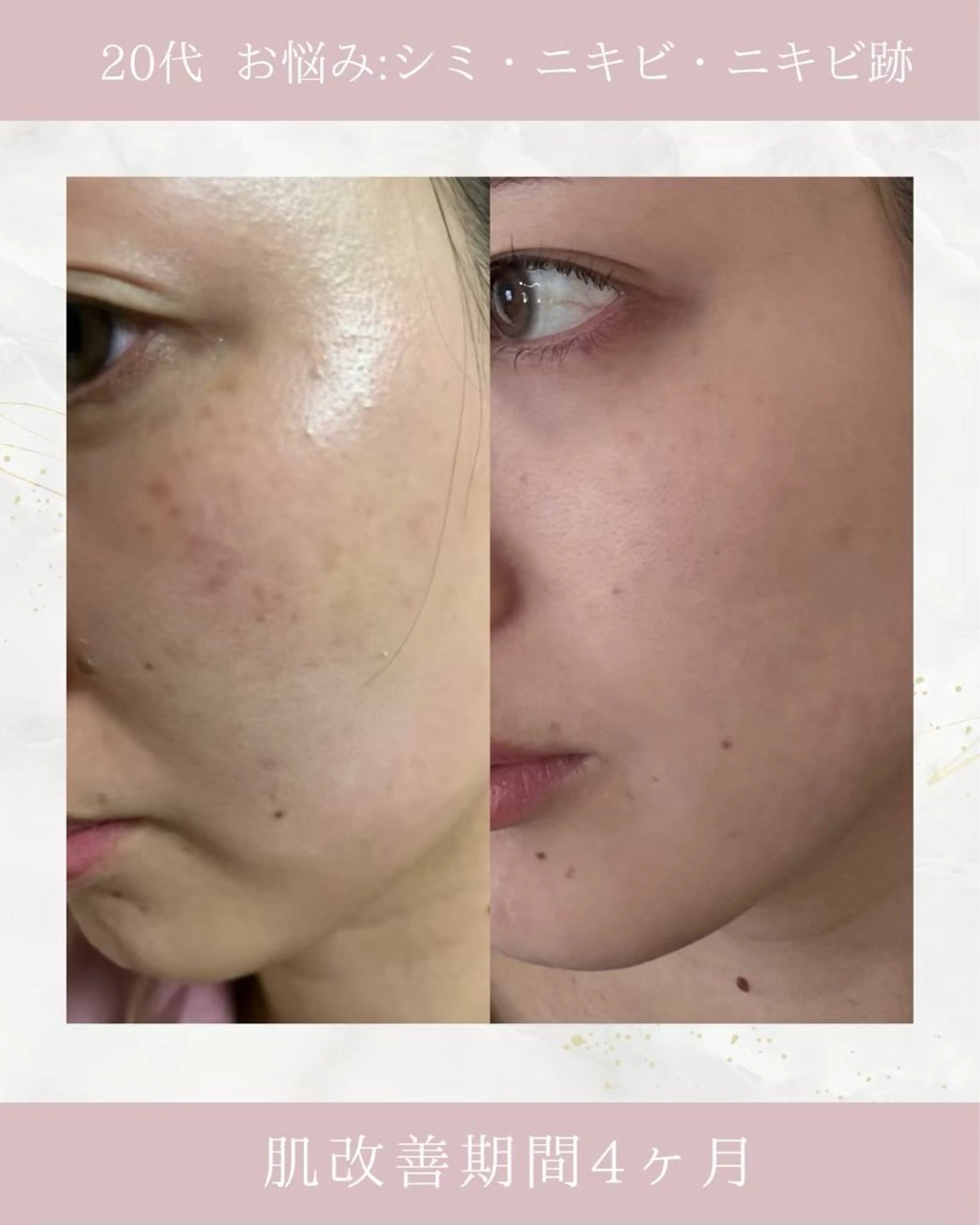 ARuru所属・ARuru 本店のエステ・リラクイメージ