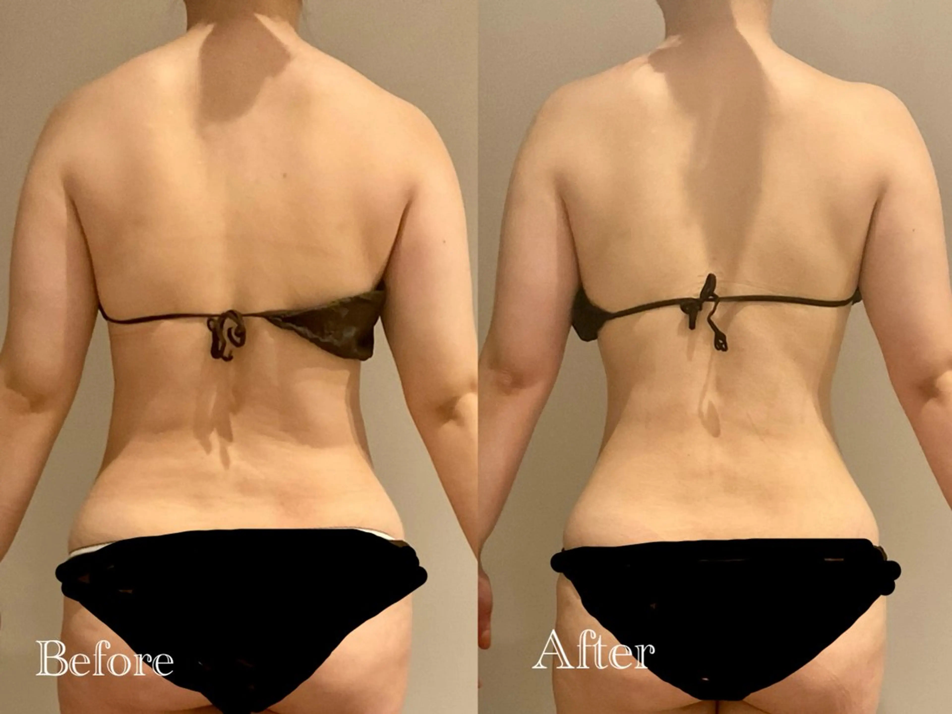 エステ リラク Esthetic MiEUXのエステ・リラクイメージ