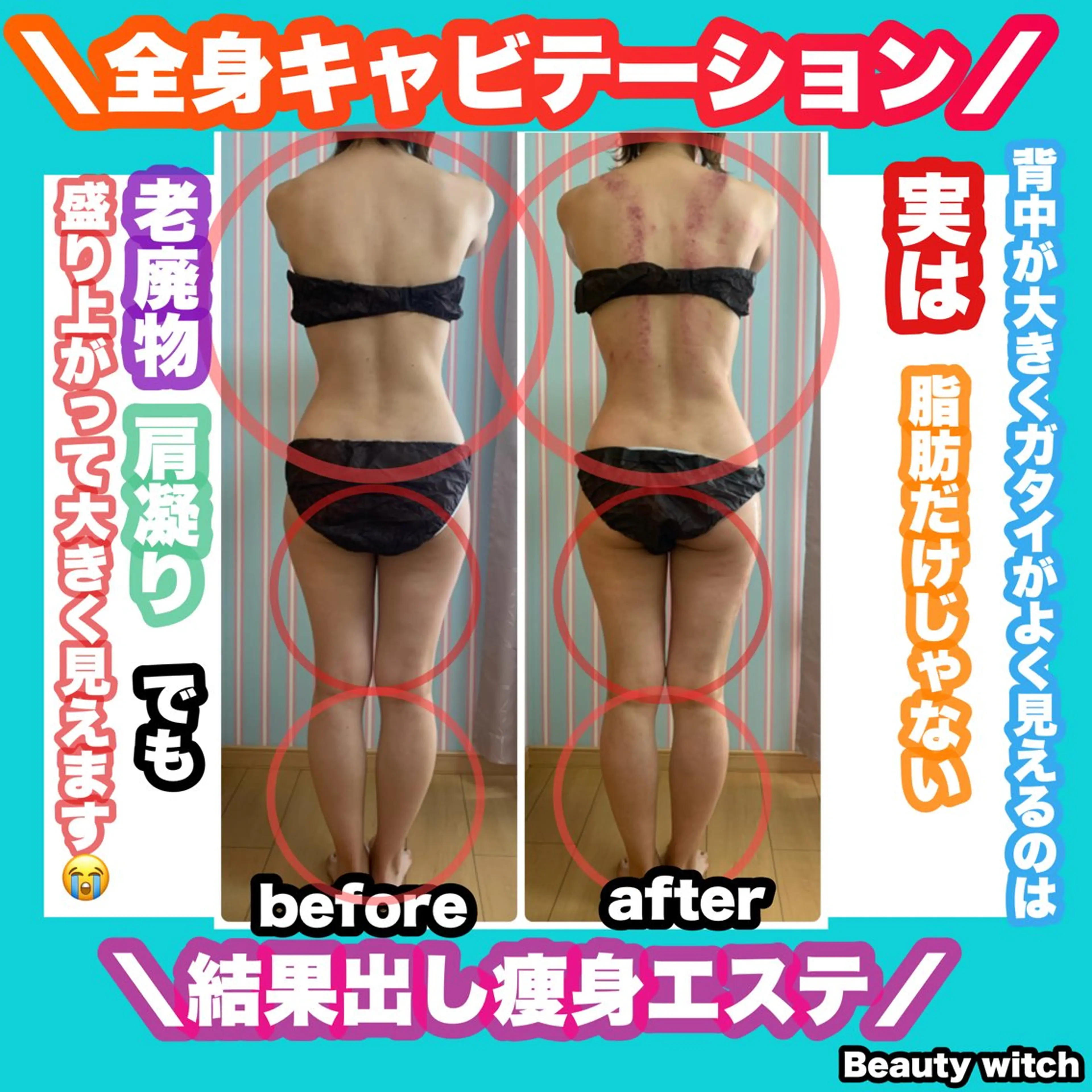 エステ リラク 痩身/脱毛/ネイル HARUKAのエステ・リラクイメージ