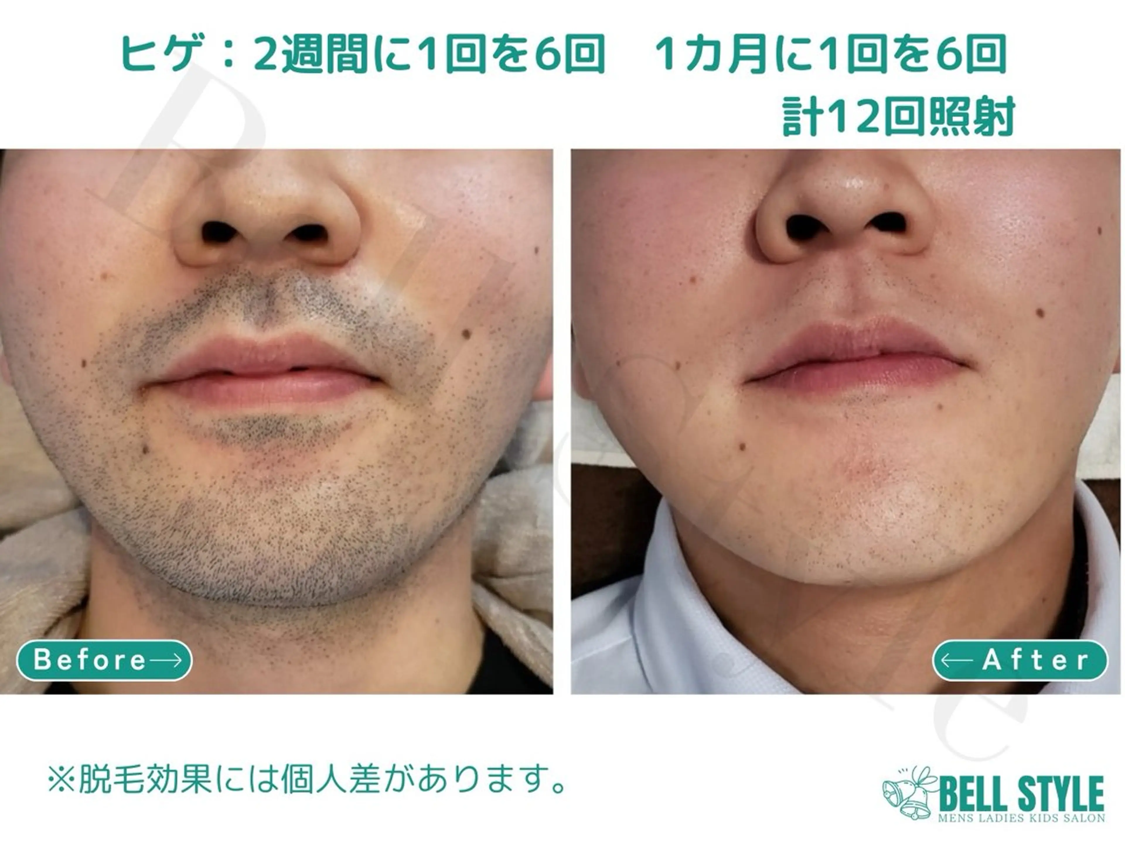 メンズ 【脱毛・美肌専門】メンズ&レディースサロンBell style所属・【脱毛・美肌専門】 bellstyleのエステ・リラクイメージ