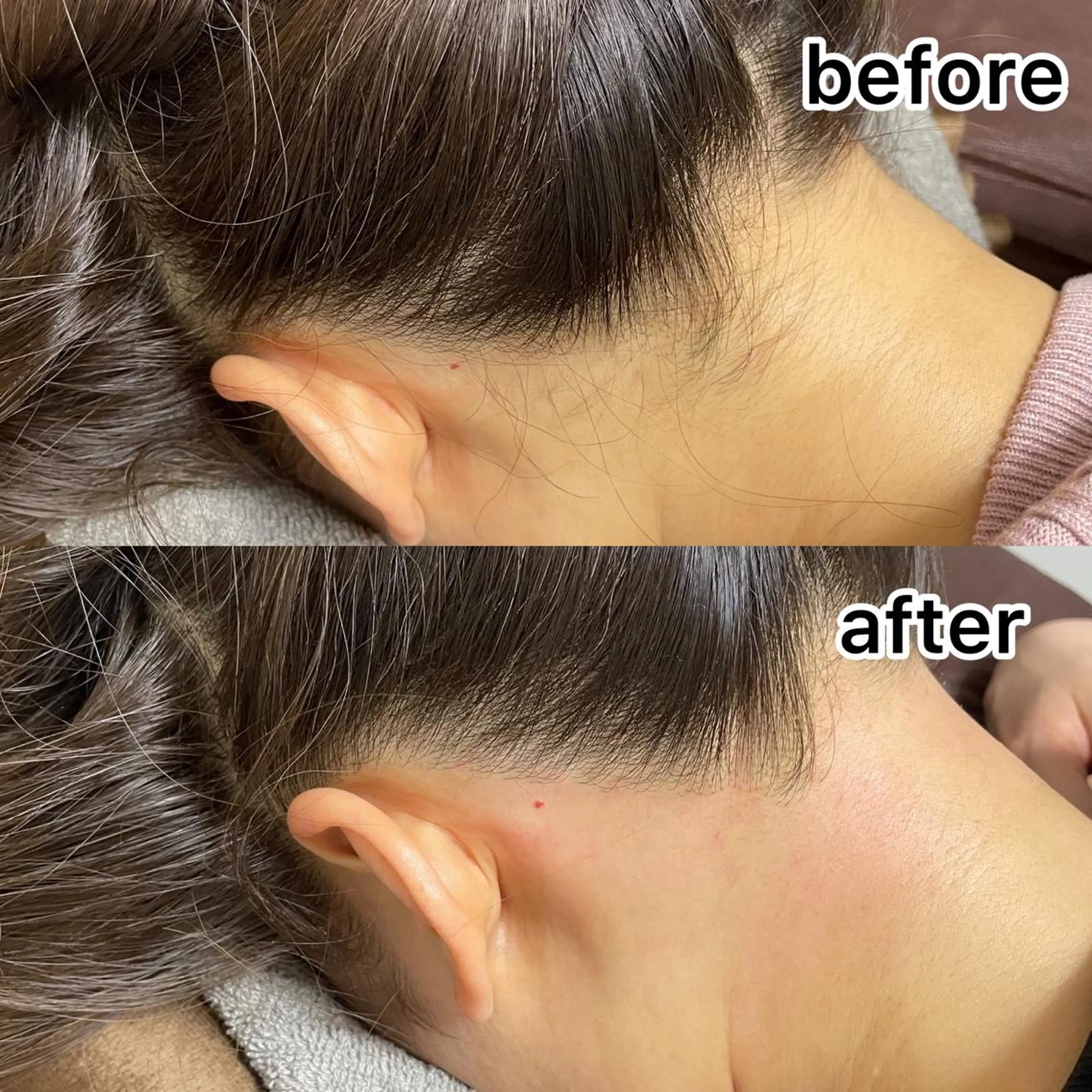 脱毛 Amm所属・🏆艶肌ワックス🏆 ララピール✨Ammのエステ・リラクイメージ