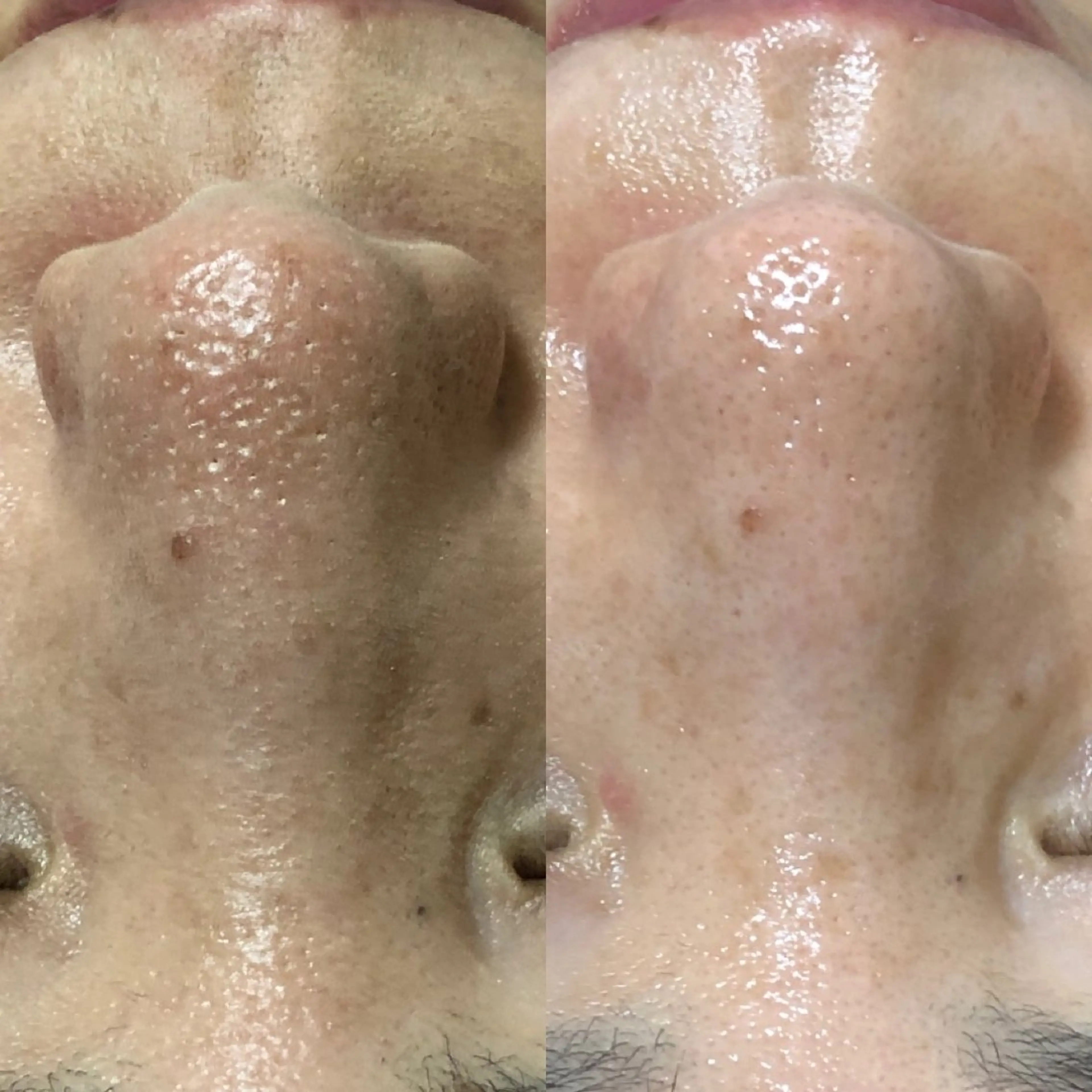 エステ Chio-RE所属・Wax/絹肌艶肌🌼 坂結加のエステ・リラクイメージ