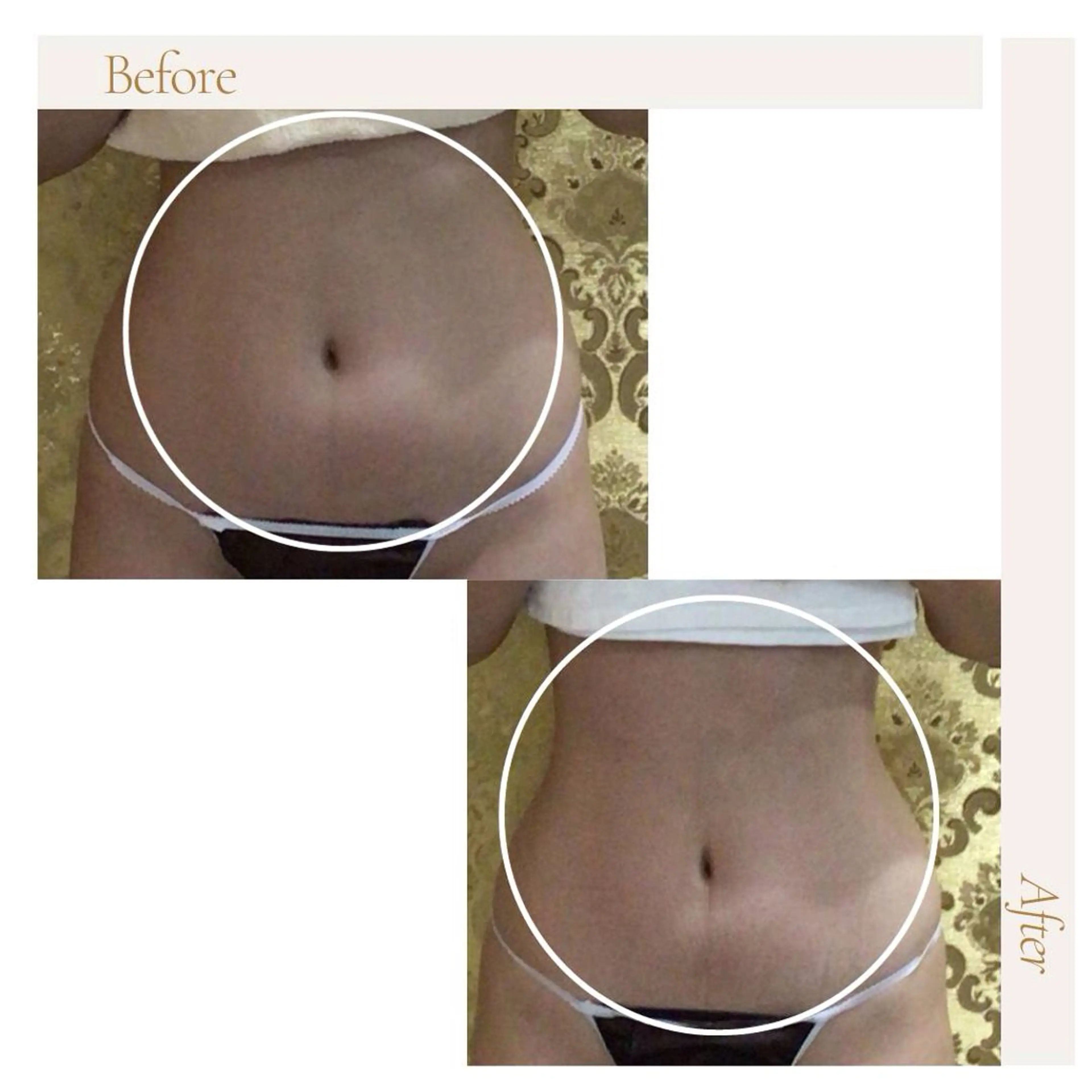 アイアンド ネイルデイのエステ・リラクイメージ