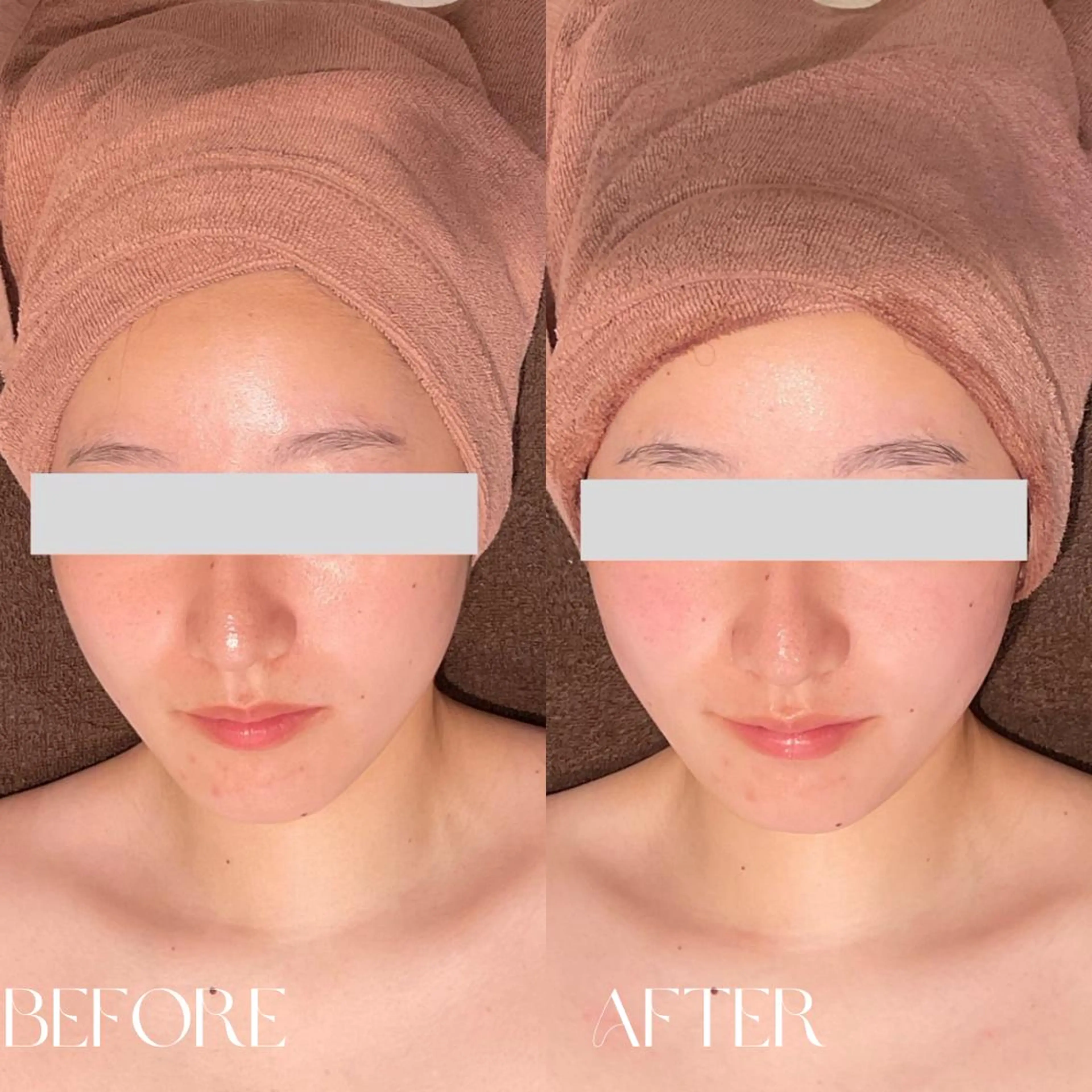 エステ リラク B-st. 下北沢のエステ・リラクイメージ