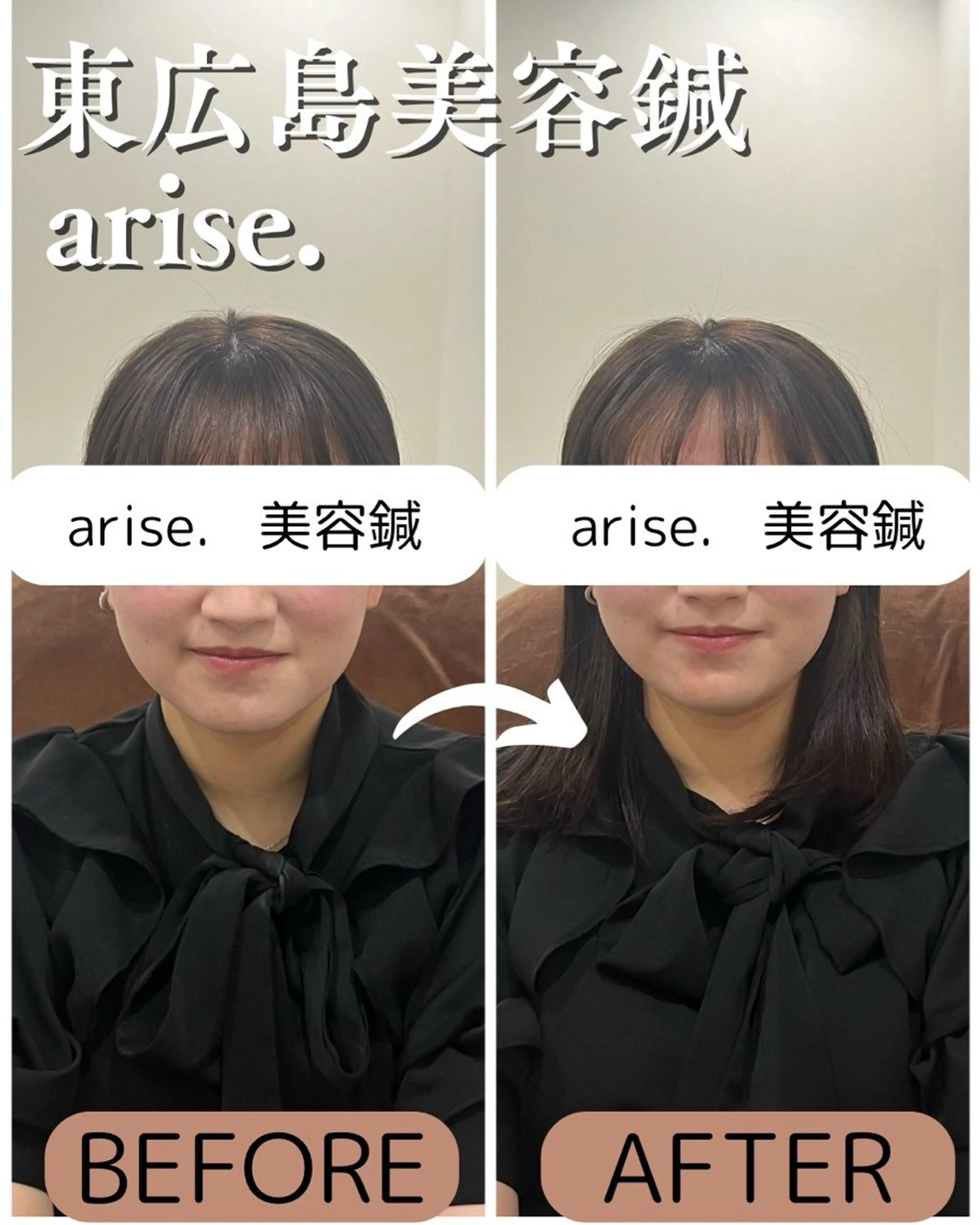 その他 arise.所属・東広島美容鍼 /arise.のその他イメージ