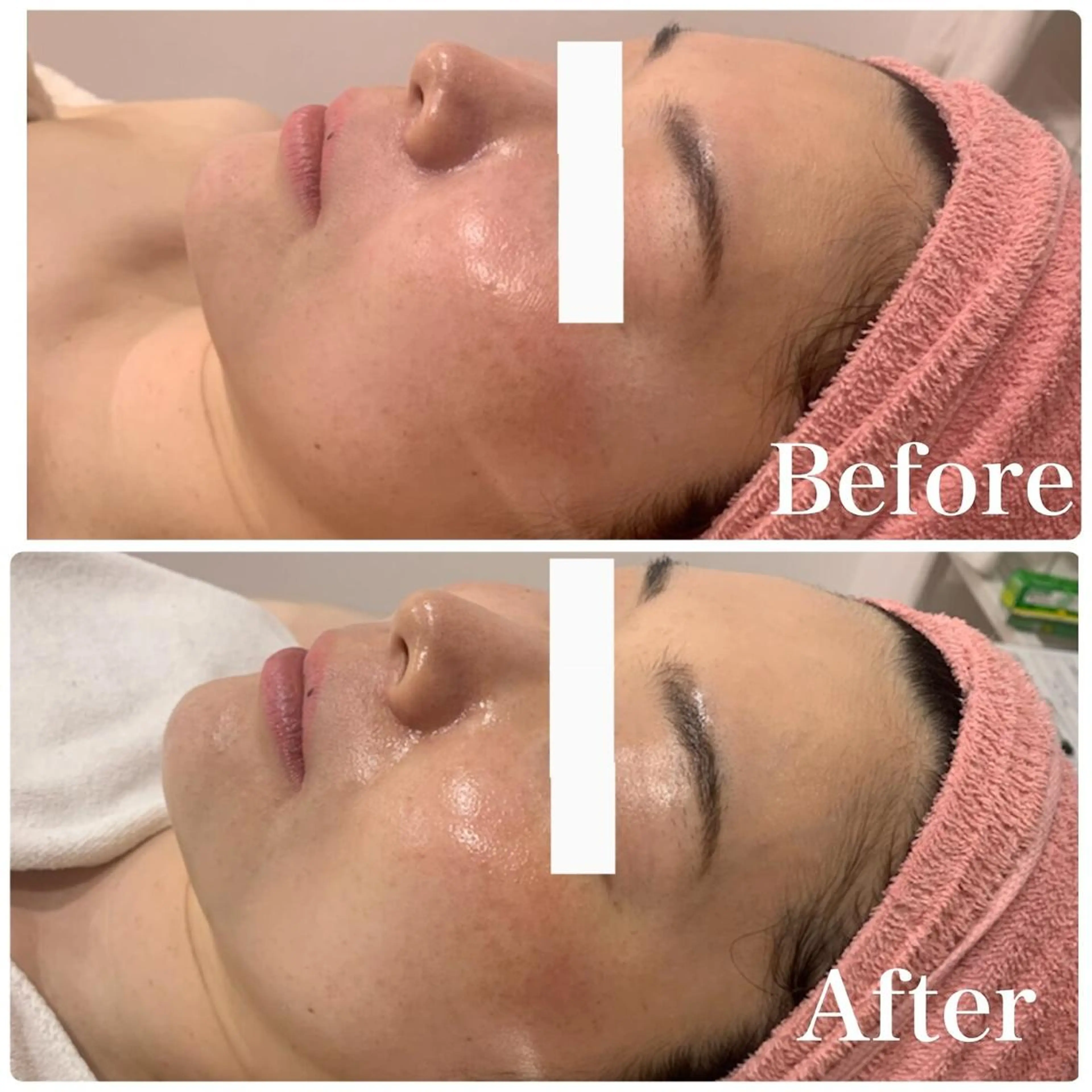 エステ 産後/ツヤ肌/子連れ /保育士在籍サロンのエステ・リラクイメージ