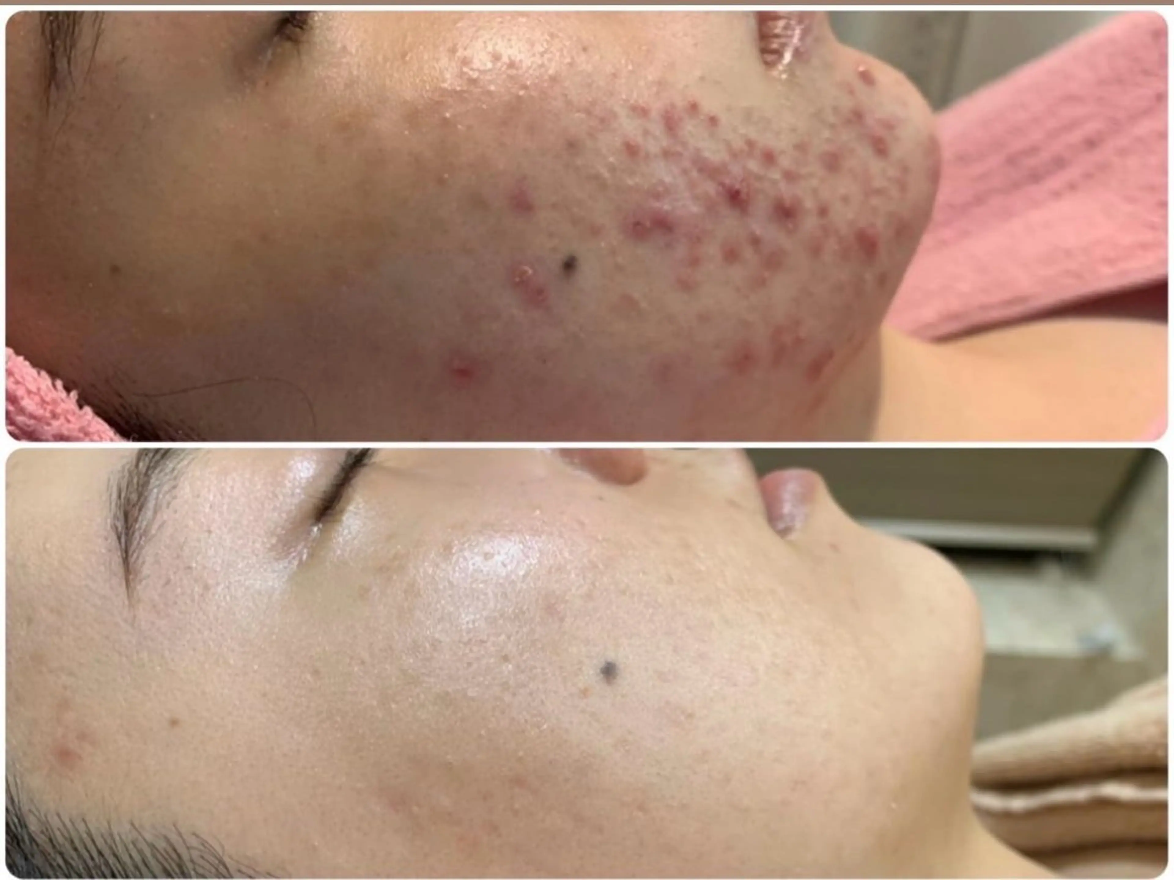 フェイシャル/脱毛 ジョアアンジェ景山のエステ・リラクイメージ