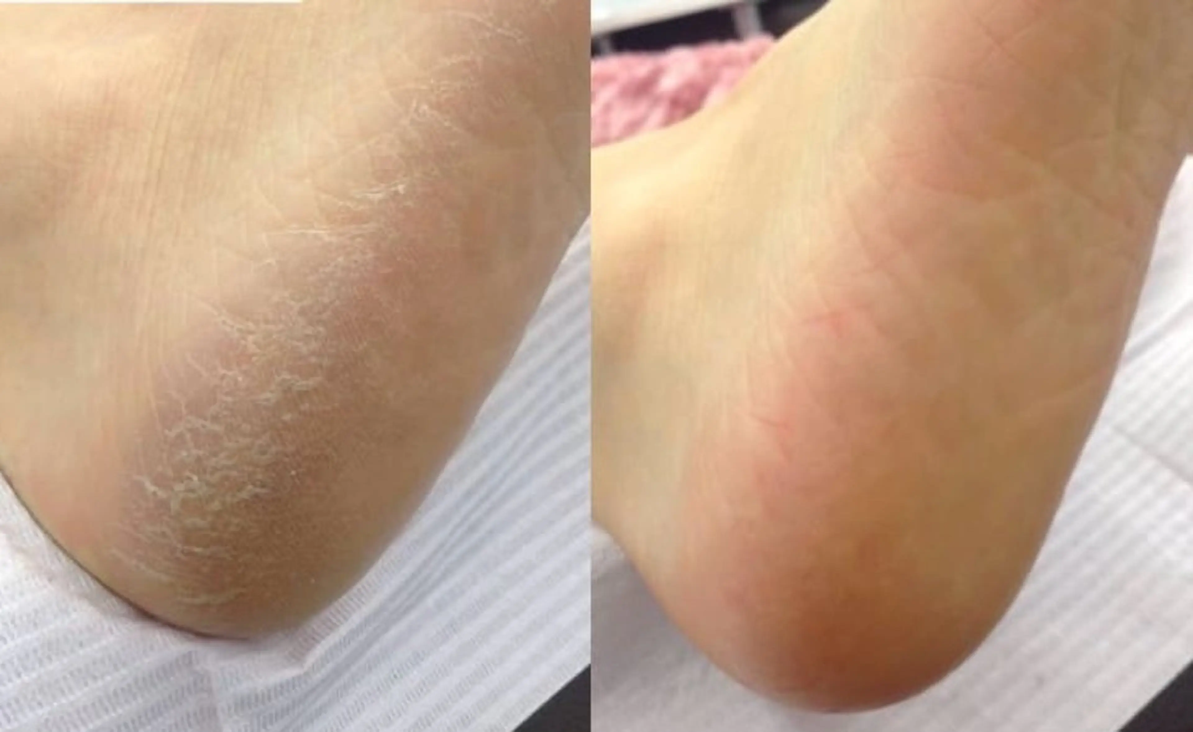 メンズ キッズ フットネイル フットケアサロンすりーぴんぐ田端店所属・🌱 ま　し　お　🌱のエステ・リラクイメージ