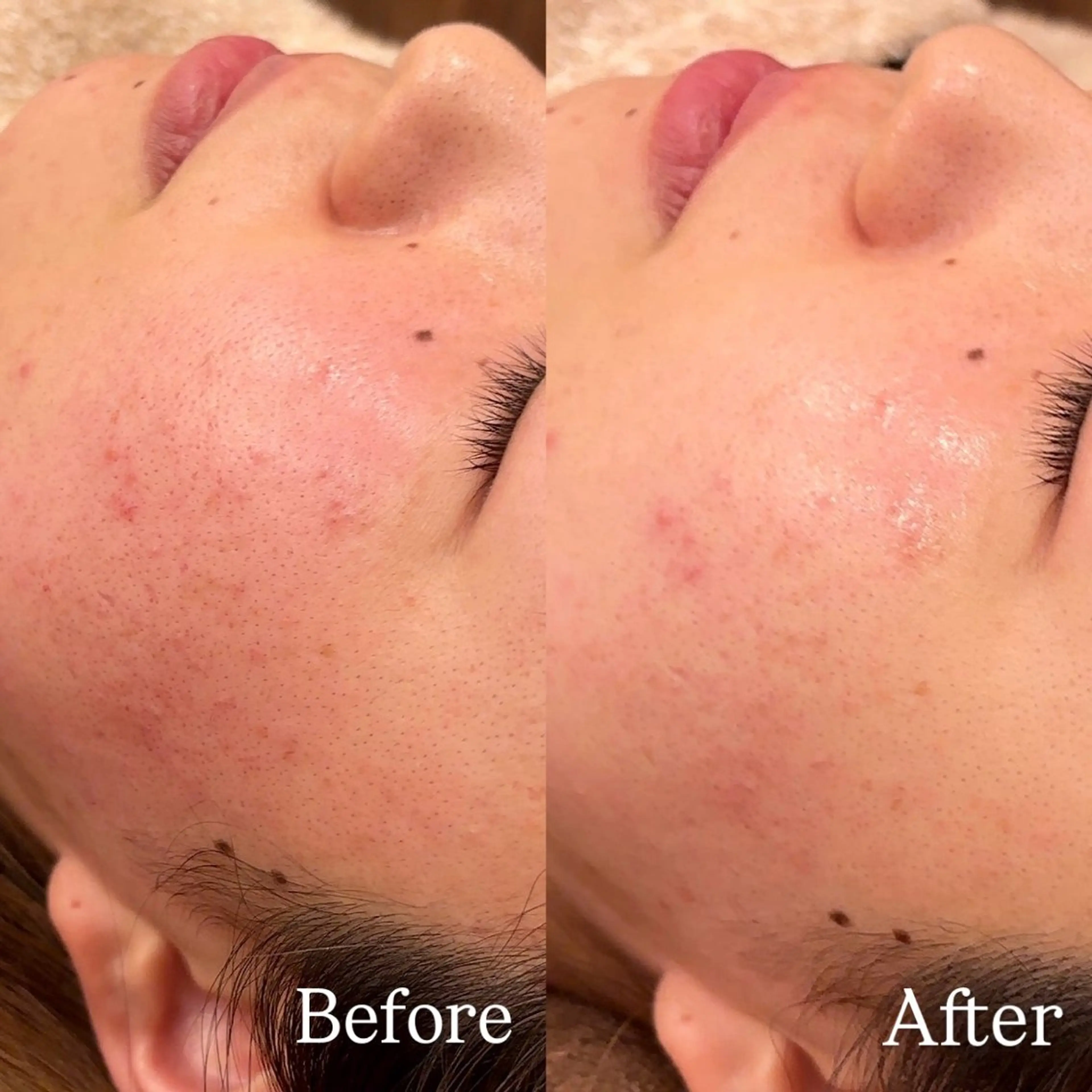 Hari Lounge恵比寿所属・chika🦋 ハリラウンジ恵比寿のエステ・リラクイメージ