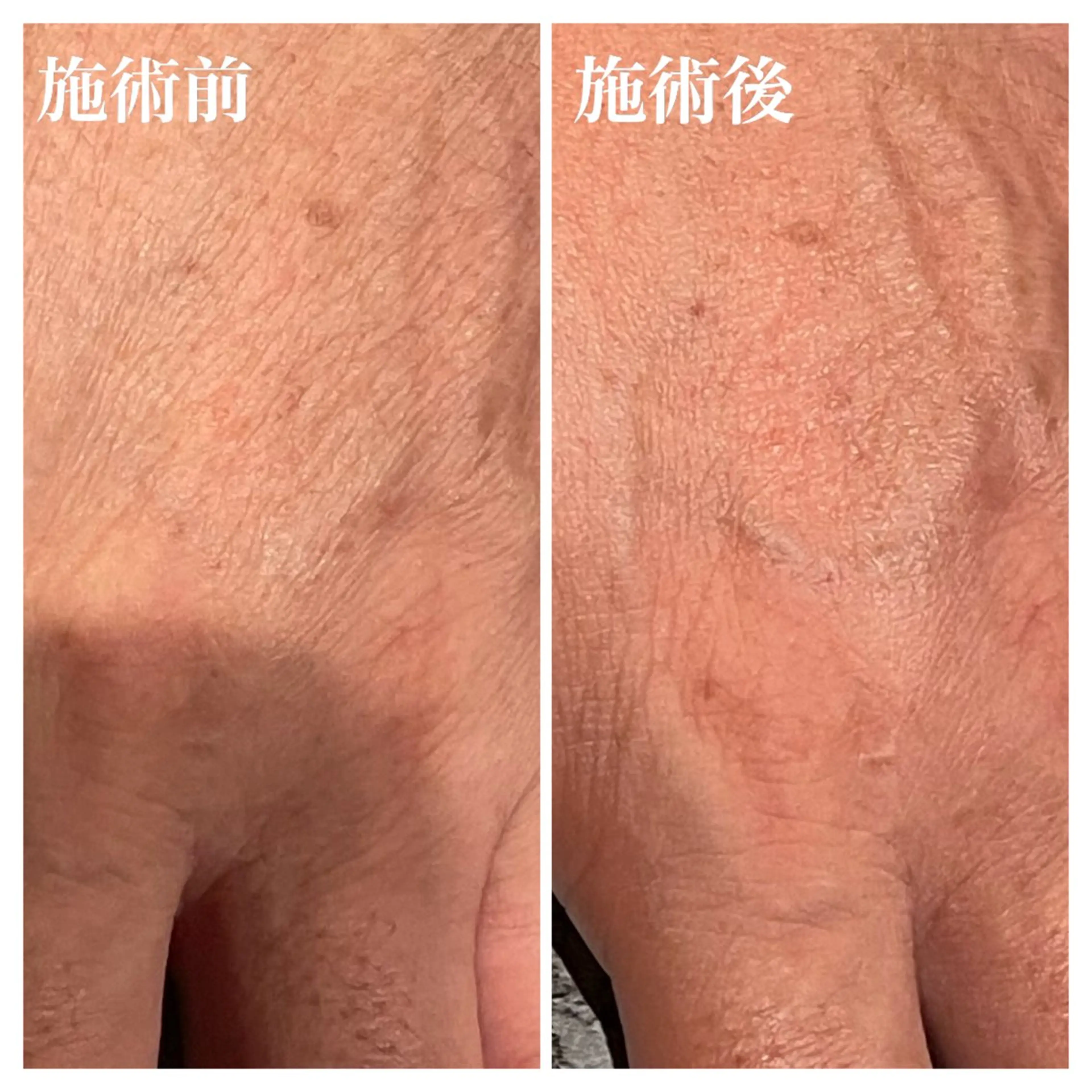 エステ リラク ハンドケア専門店 Mivian.のエステ・リラクイメージ