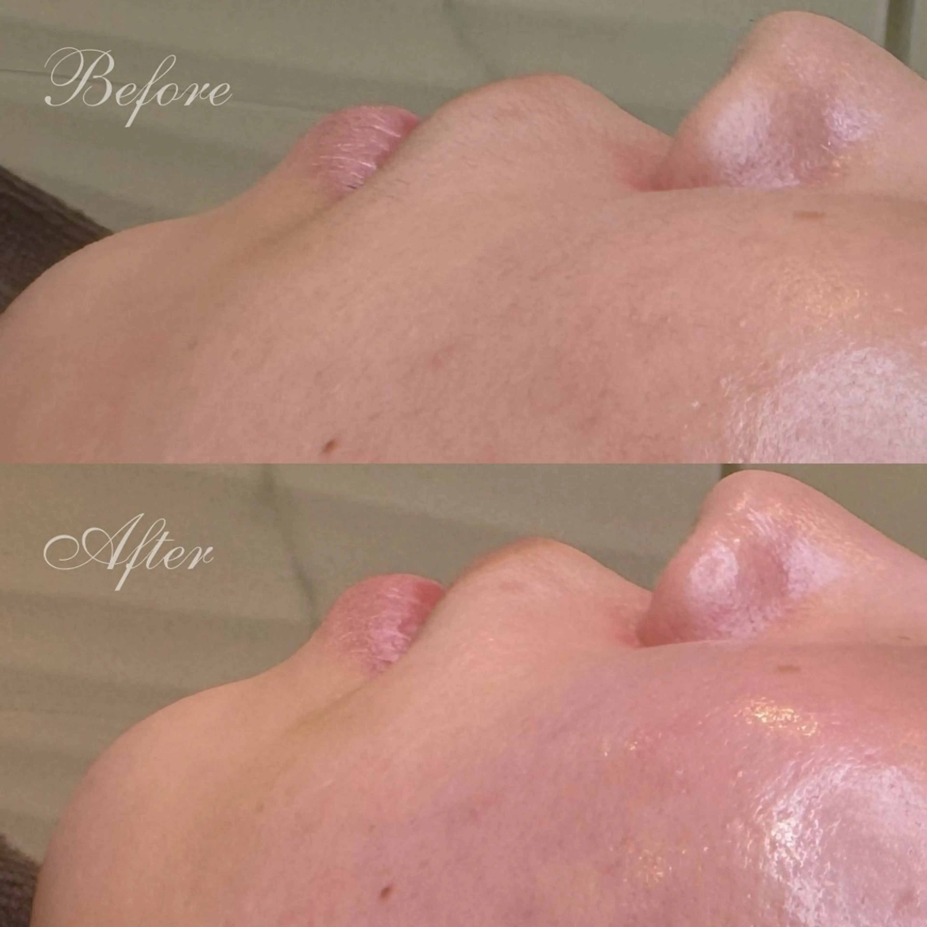 フェイシャルワックス+肌再生パックの写真