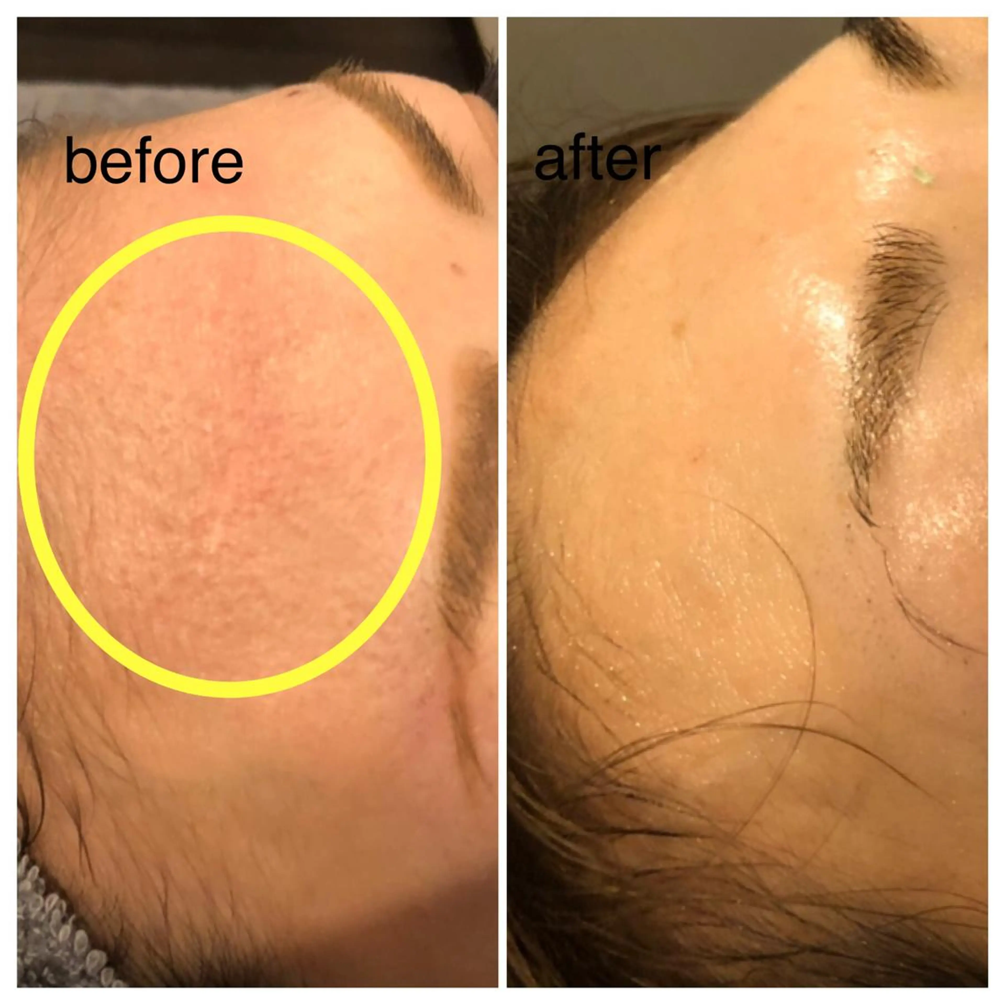 カラー パーマ ヘアアレンジ ネイル マツエク・マツパ アイブロウ 赤色 春ネイル SALON SINCERITEのエステ・リラクイメージ