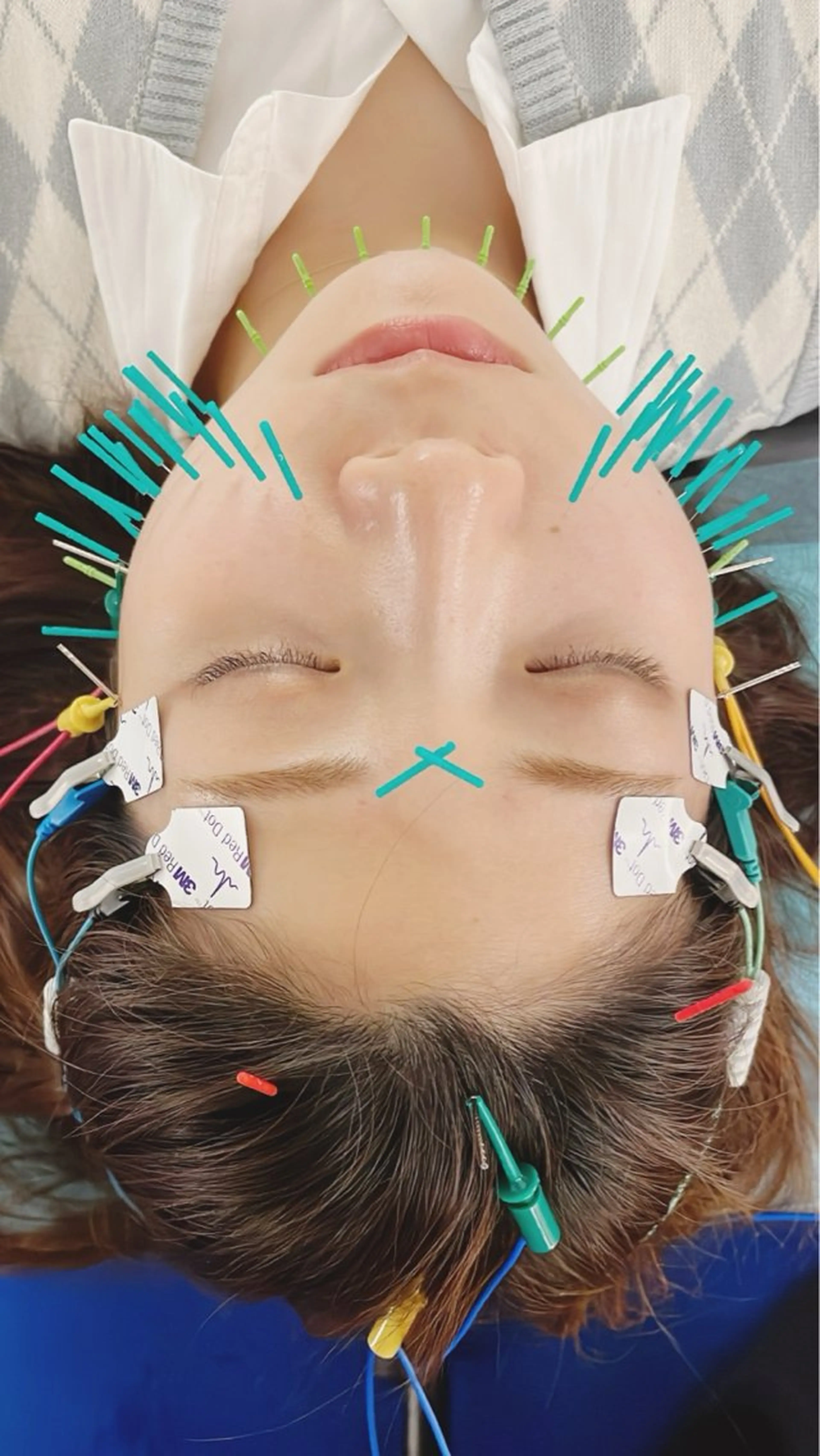 小顔美容鍼専門サロン 渋谷YZのエステ・リラクイメージ