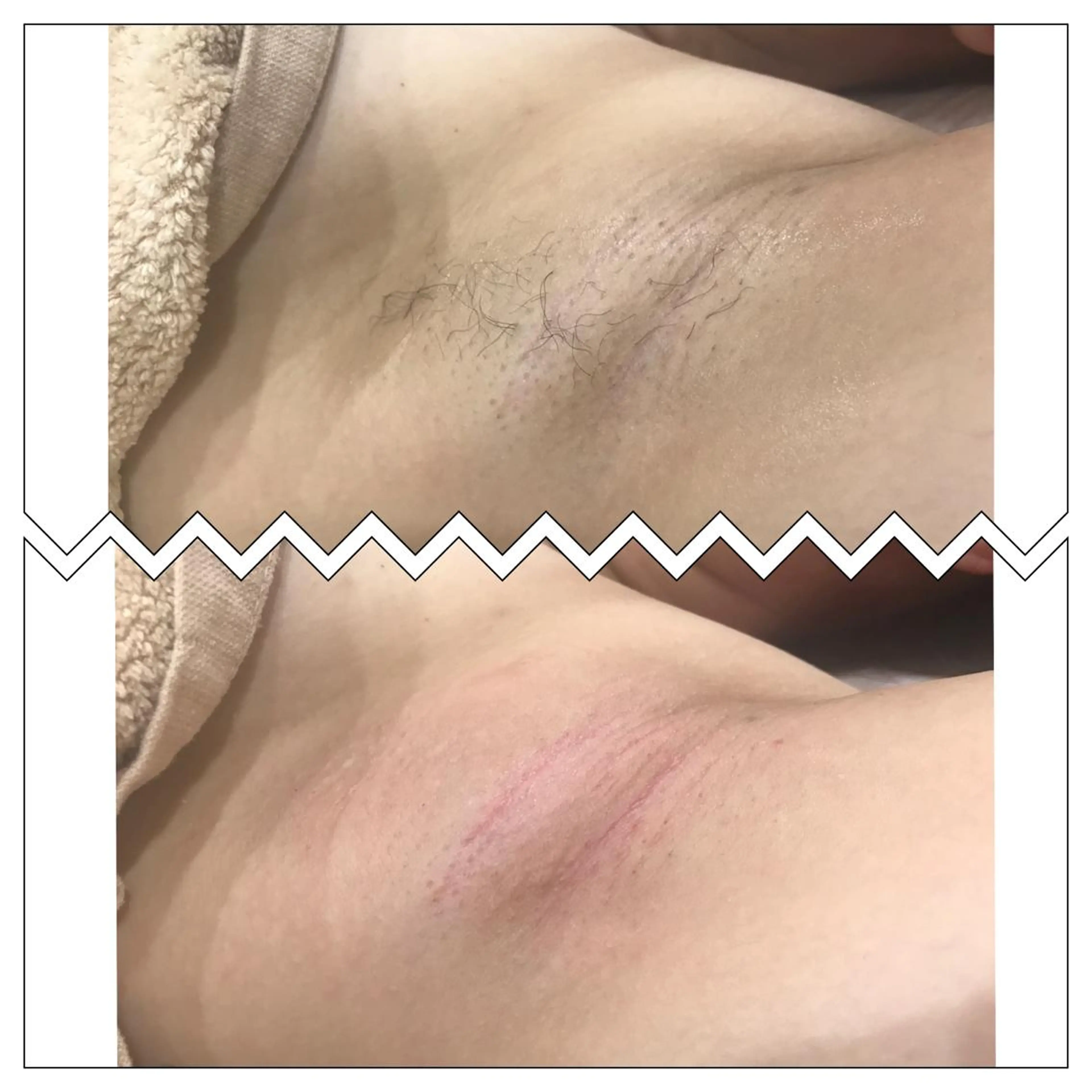 フェイシャル/脱毛 ジョアアンジェ　田中のエステ・リラクイメージ