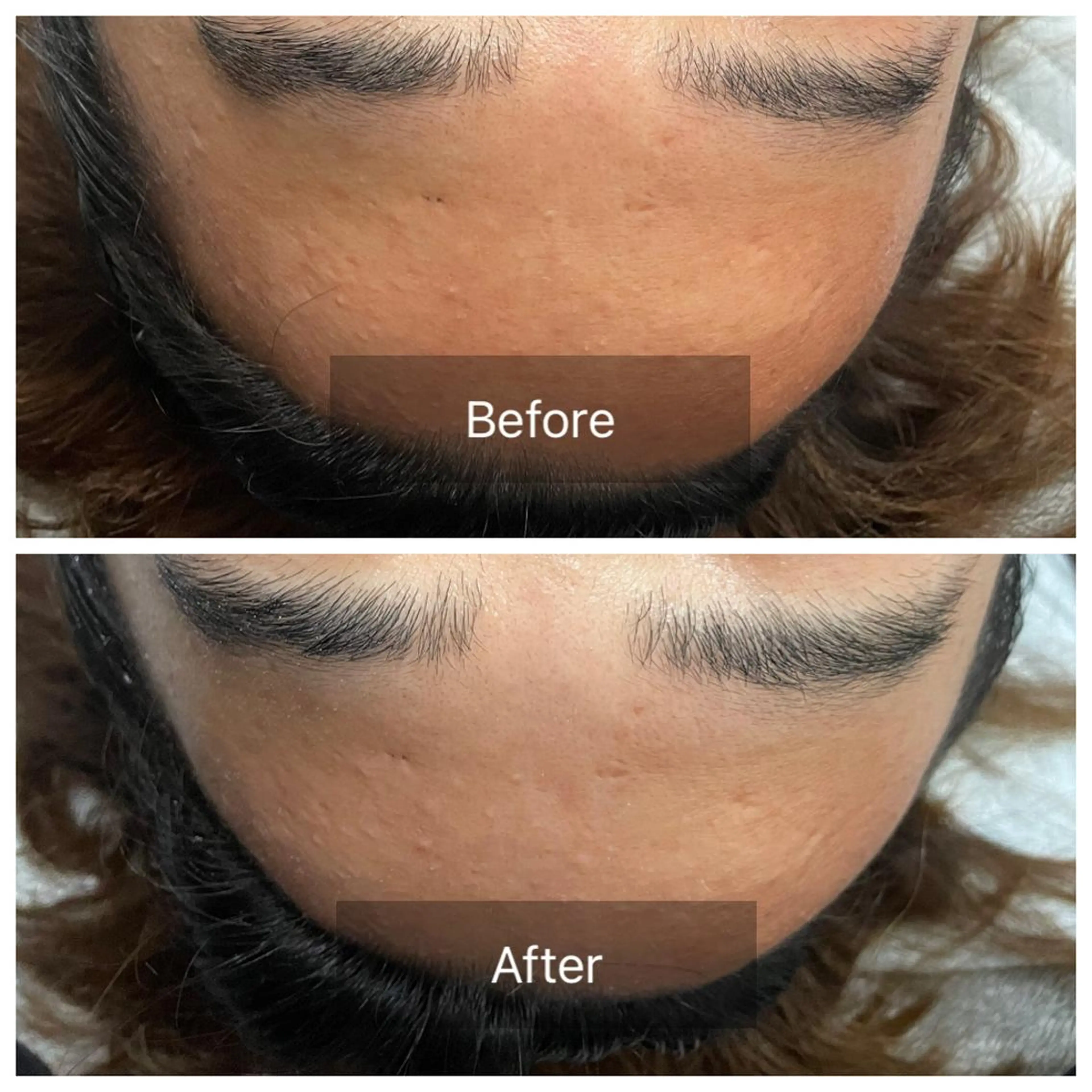 肌質改善サロン facialmoonのエステ・リラクイメージ