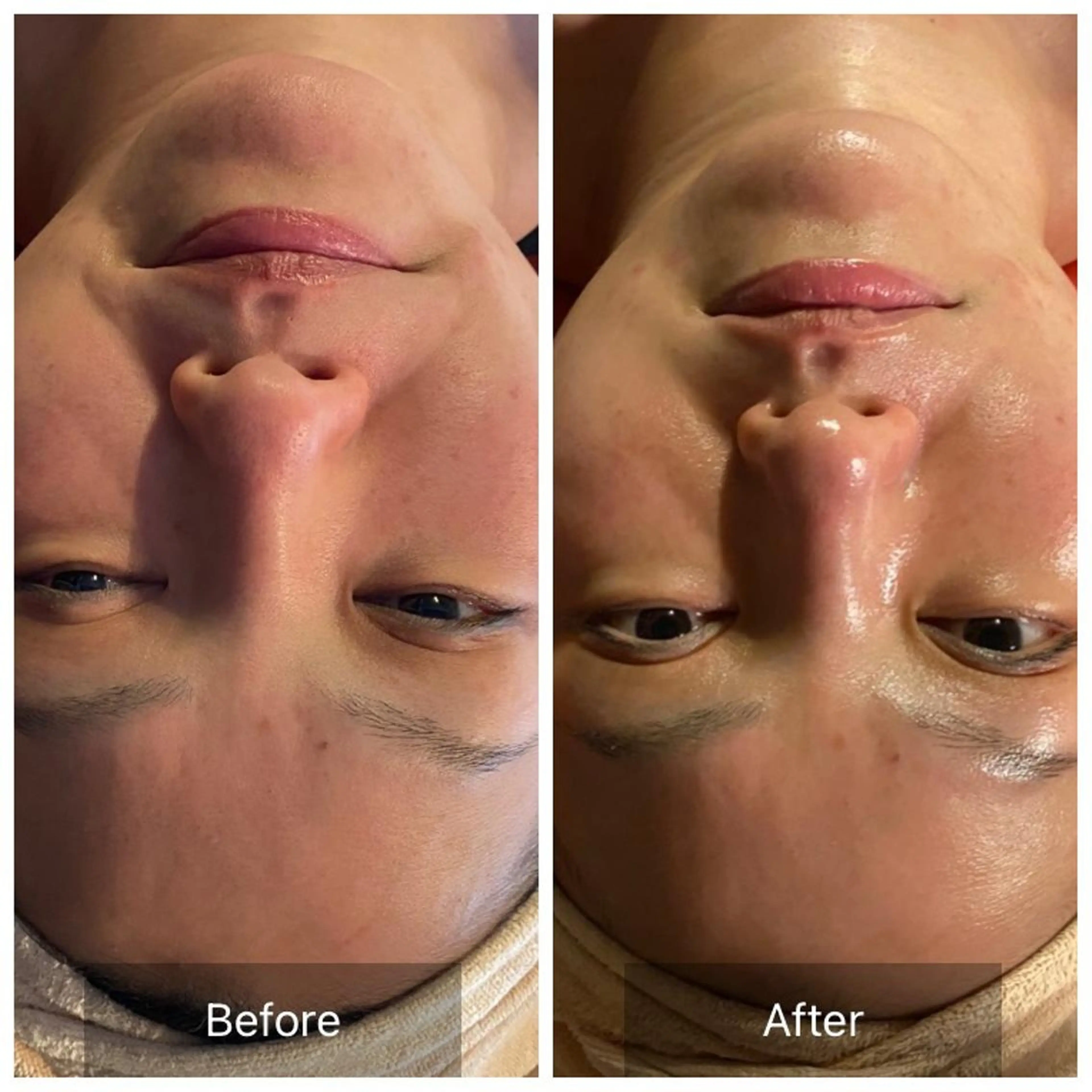 Mandarin Orange所属・毛穴から始める肌メン テマンダリンオレンジのエステ・リラクイメージ