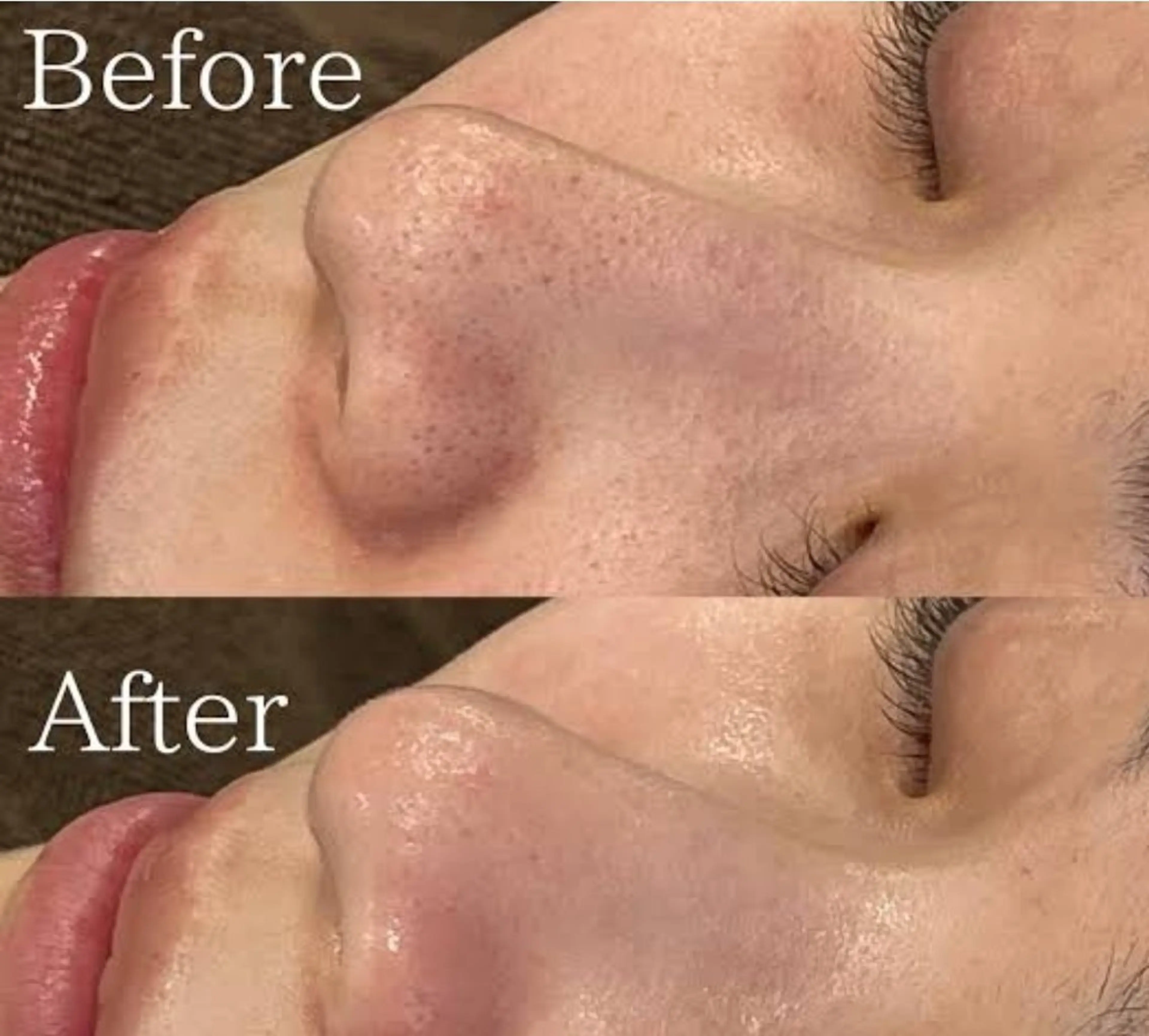 ハルモニア所属・エステハルモニア はるかのエステ・リラクイメージ