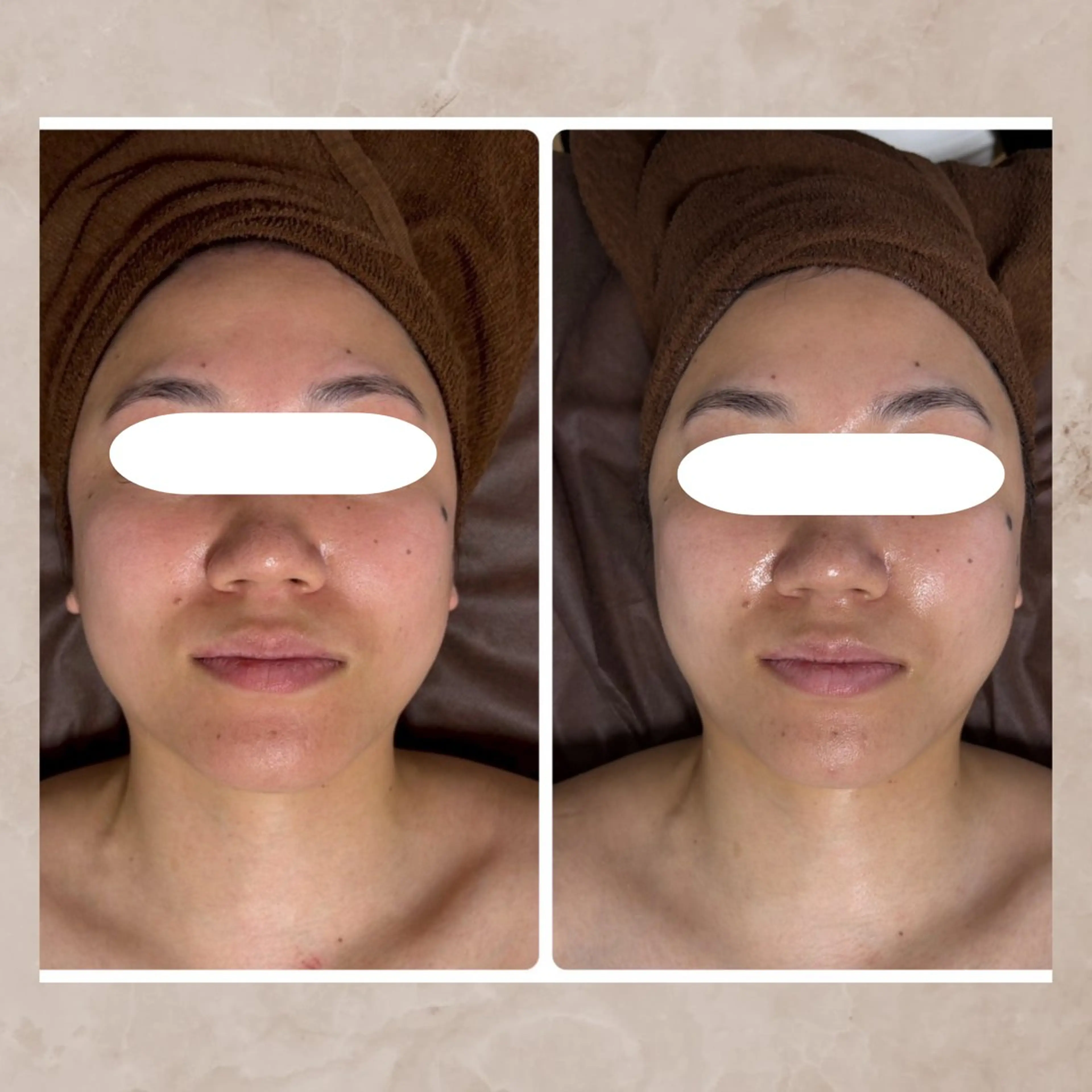 エステ リラク Total Beauty Salon Vi's CLUB by BINEL所属・Vi's CLUB KOTONOのエステ・リラクイメージ