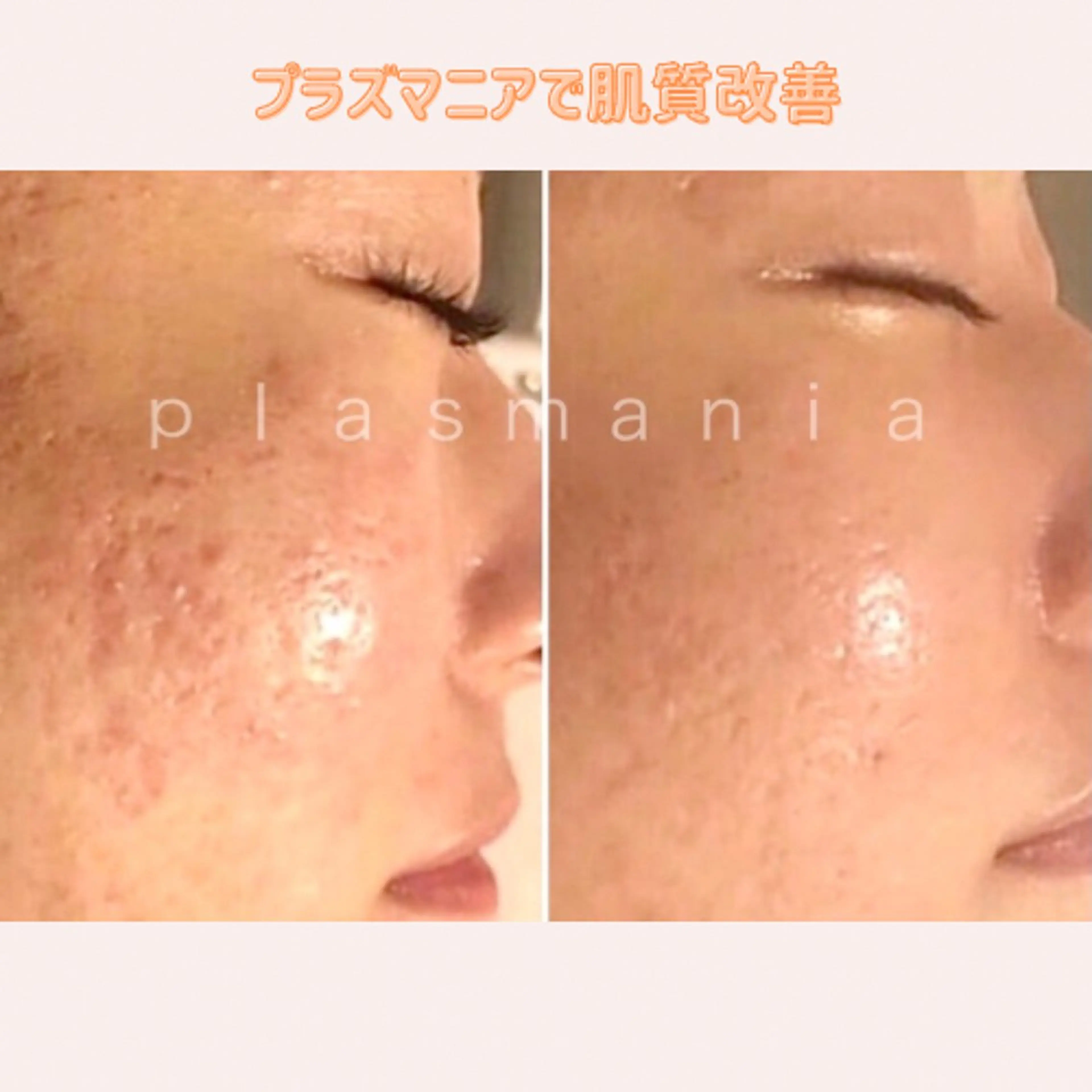 肌質改善｜エステ Connect ゆいのエステ・リラクイメージ