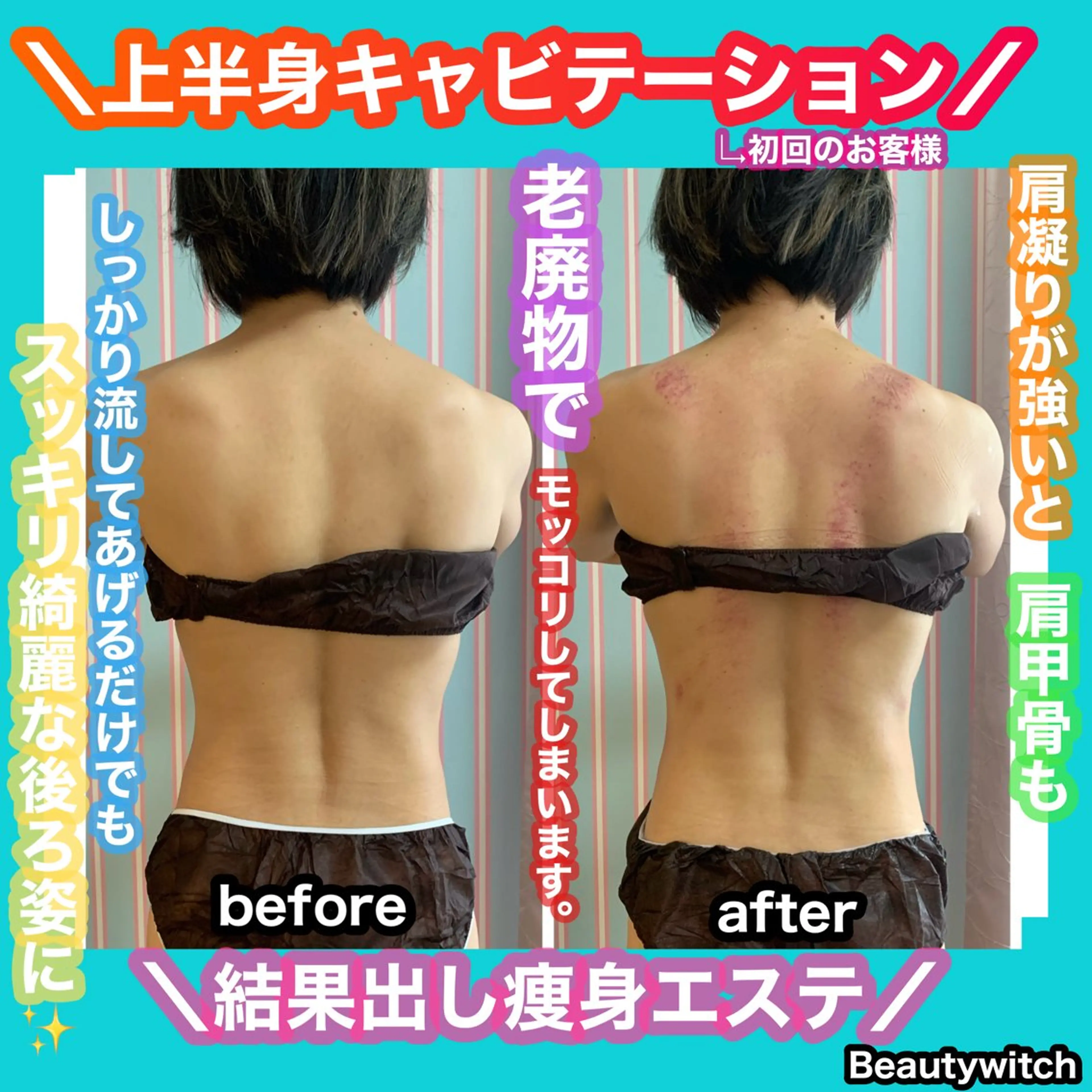 エステ リラク 痩身/脱毛/ネイル HARUKAのエステ・リラクイメージ