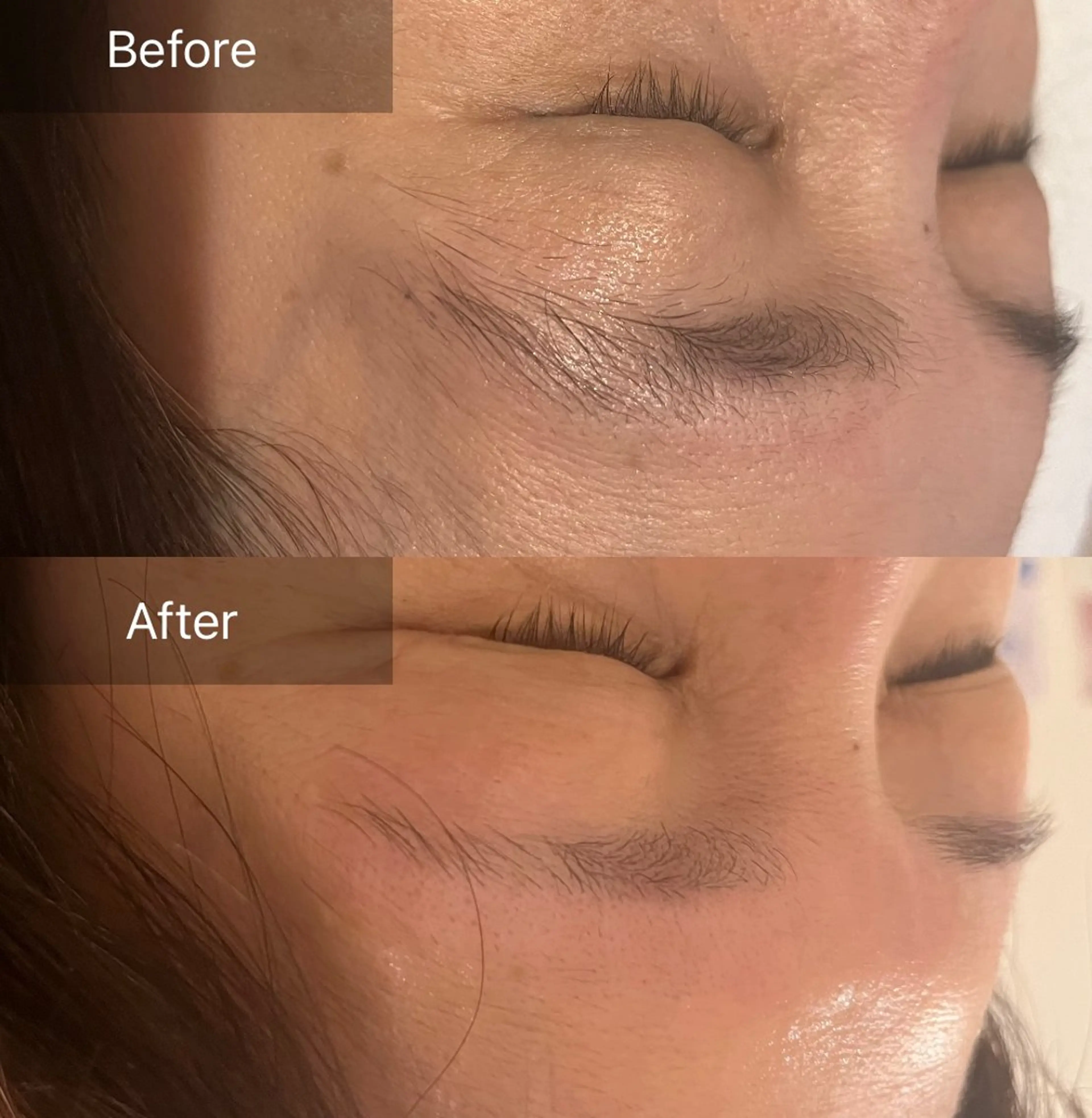 アイブロウ ワックス脱毛 眉カット その他(アイブロウ) for woman所属・森 美優のエステ・リラクイメージ