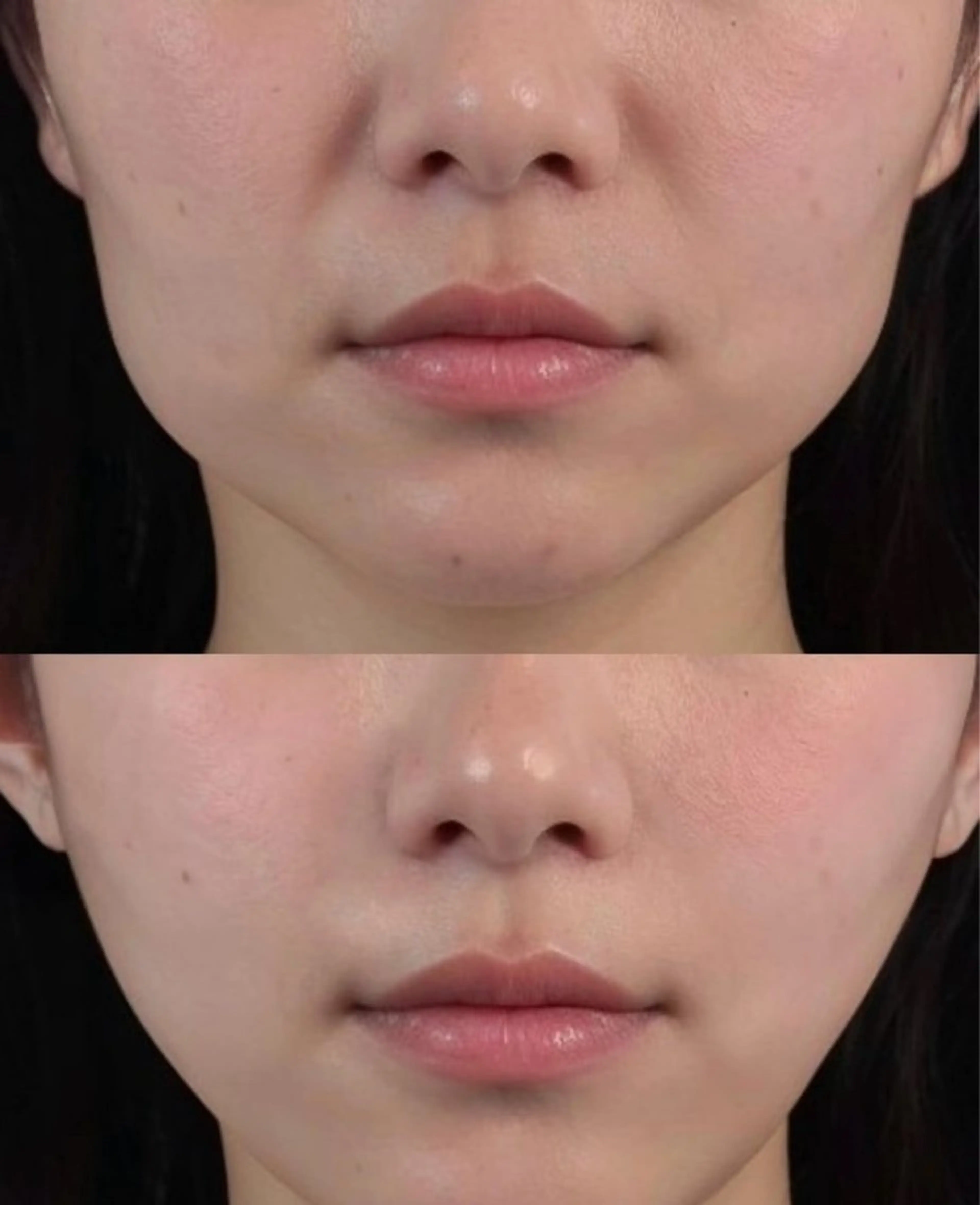 エステ リラク 愛維美水光美肌専門店所属・愛維美水光美肌専門店 メンズレディースokのエステ・リラクイメージ