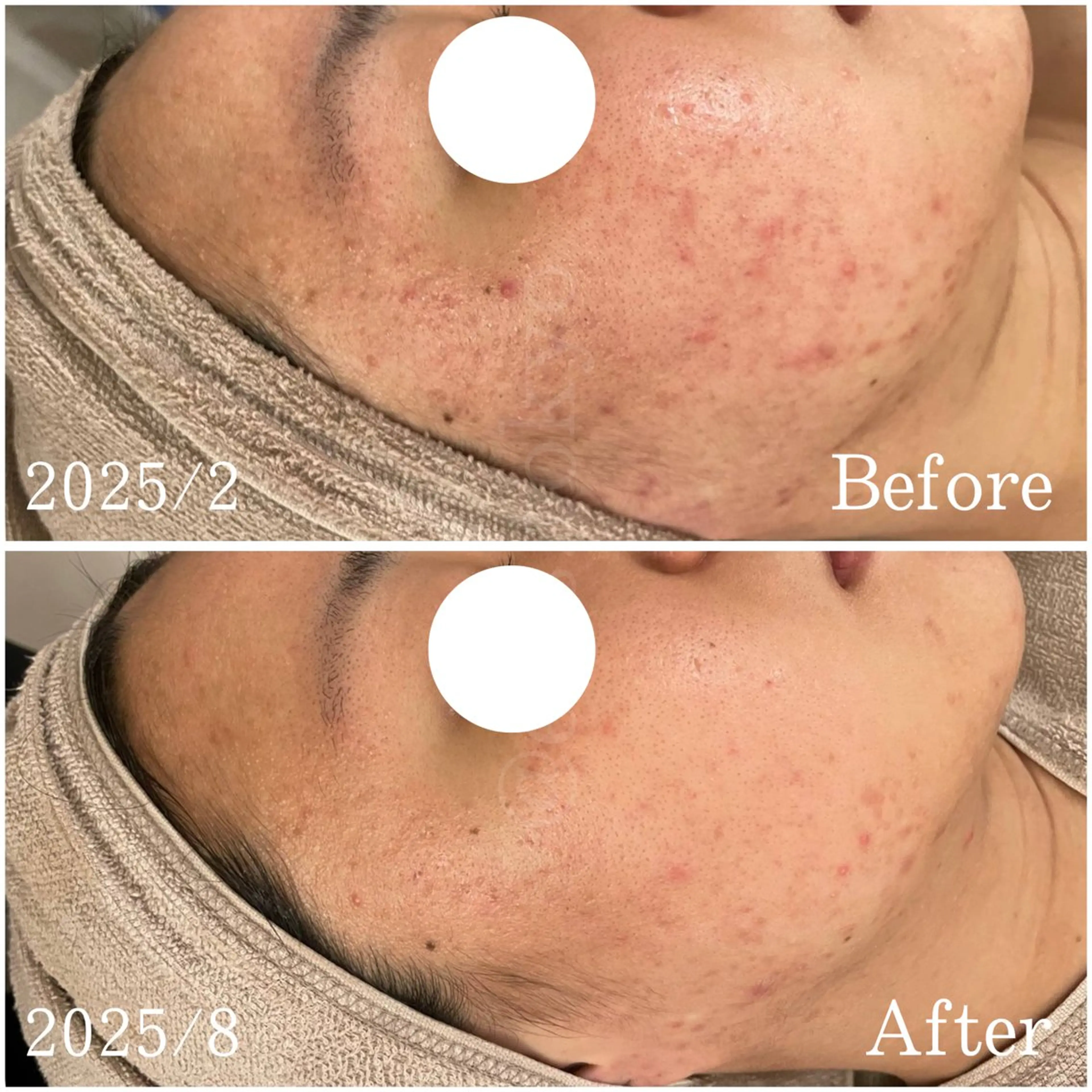 etes （エトエス）所属・etes.tokyo 中目黒のエステ・リラクイメージ