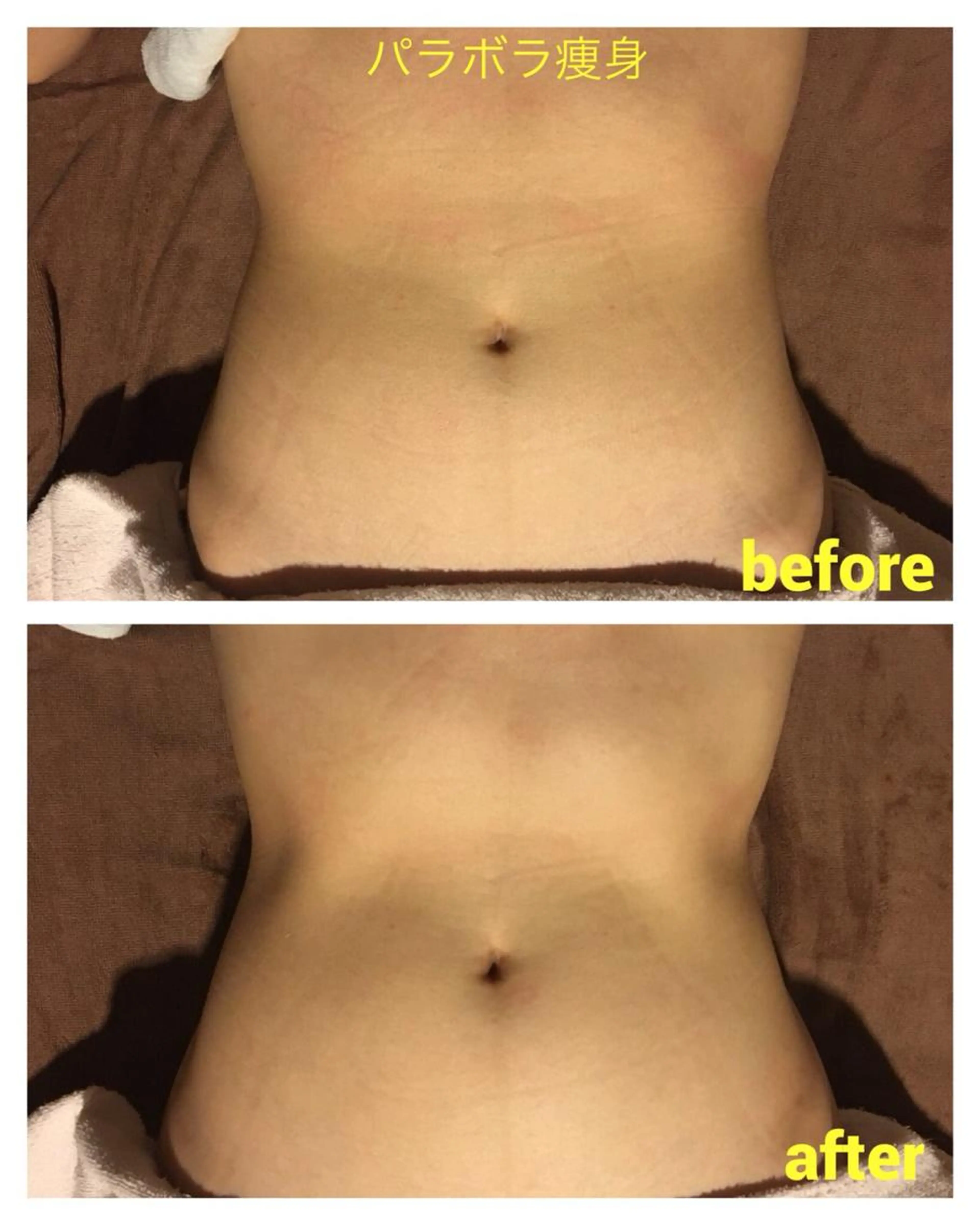 初回2パーツまで半額　パラボラ痩身の写真