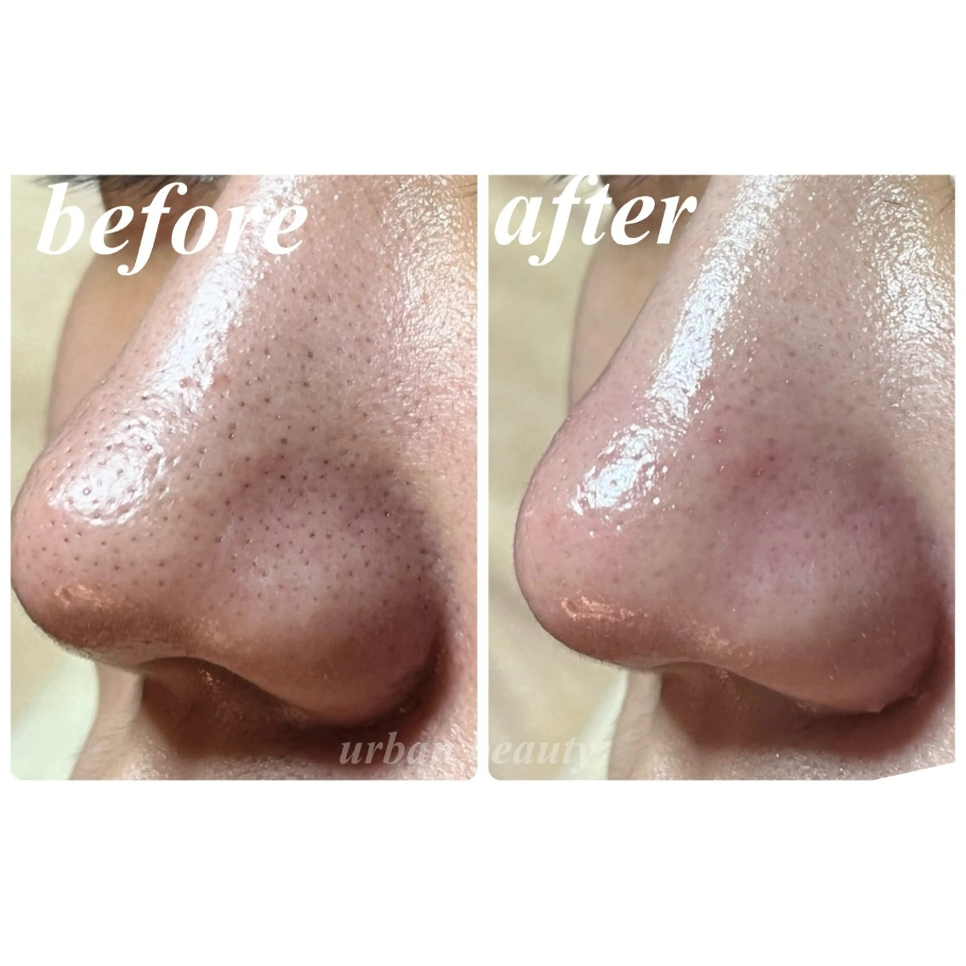 エステ リラク 結果重視｜毛穴エステ ｜友綱理恵のエステ・リラクイメージ