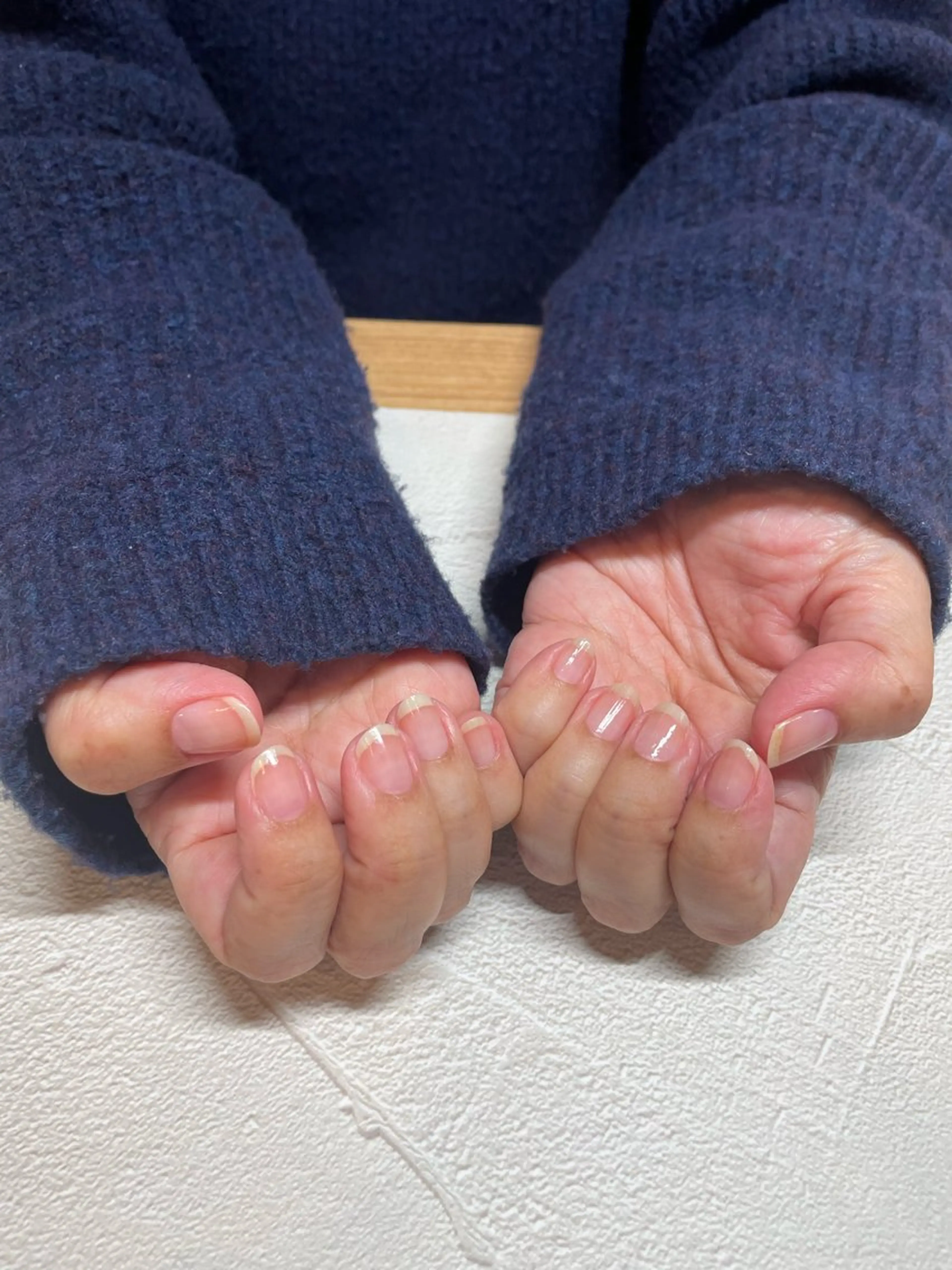 ハンドケア&トリートメント(肘まで)の写真