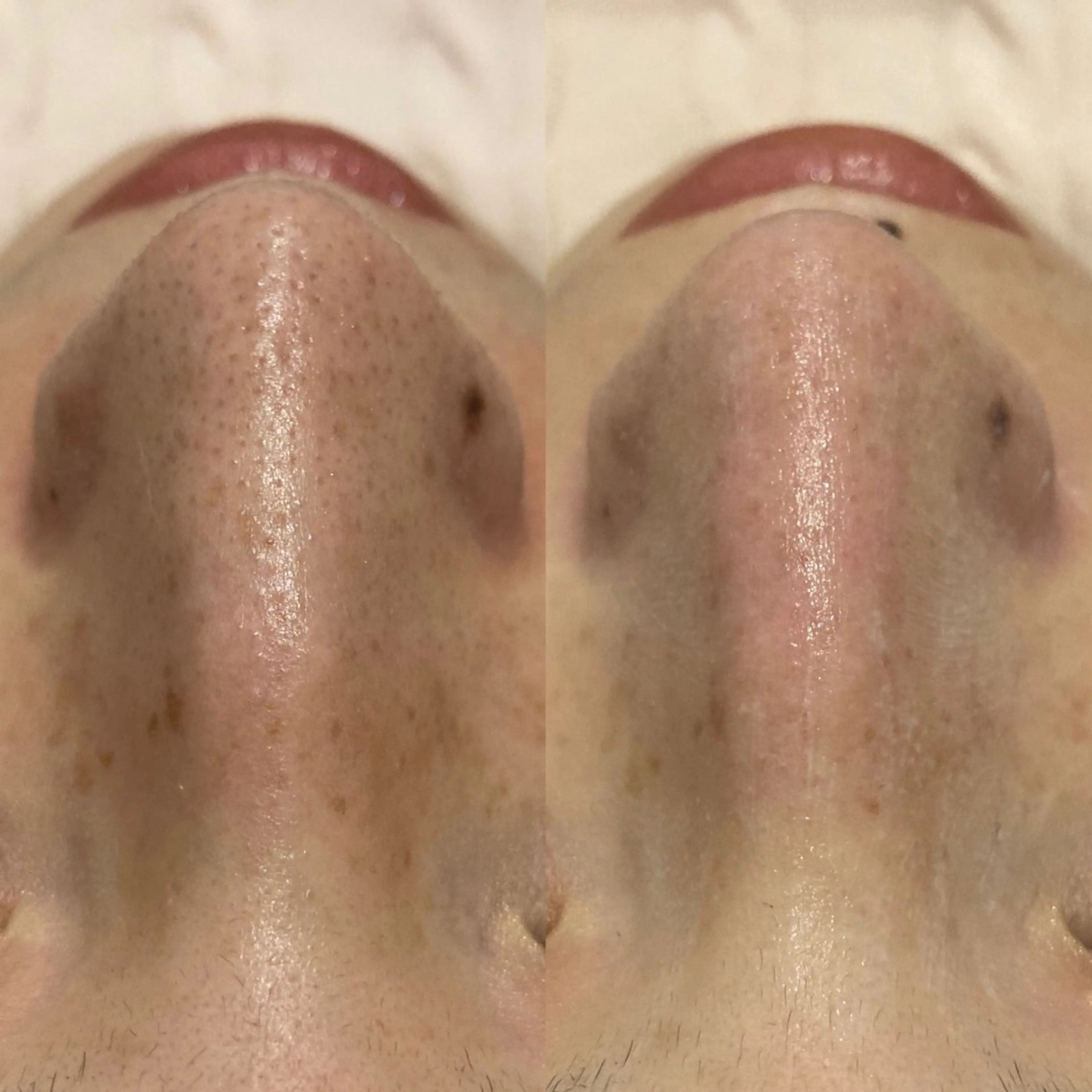 エステ NANI OAFU所属・NANIOAFU [なんば店］のその他イメージ