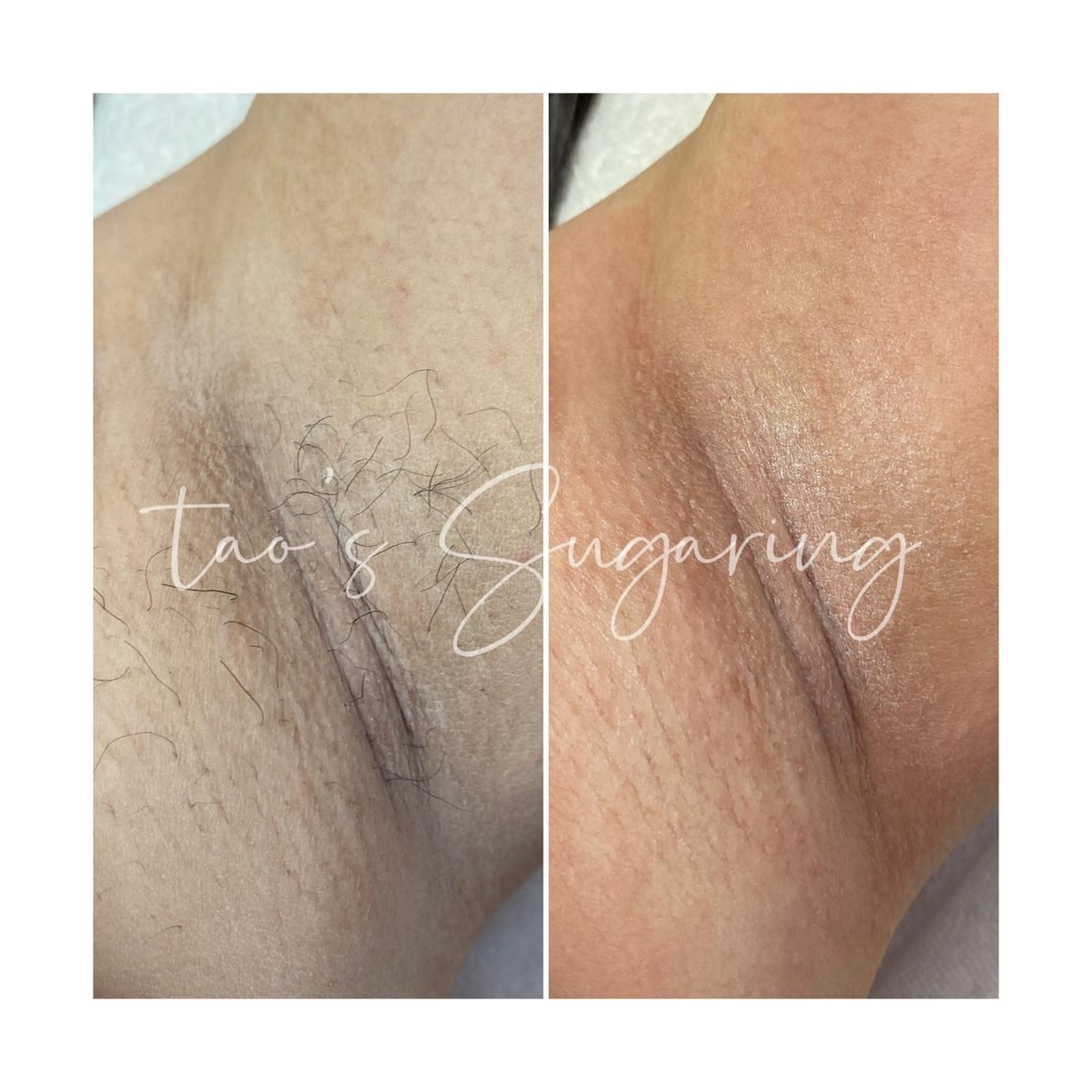 Sugaring / HILOT TAOのエステ・リラクイメージ